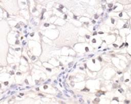 Detection of human HIF1-alpha by immunohistochemistry.