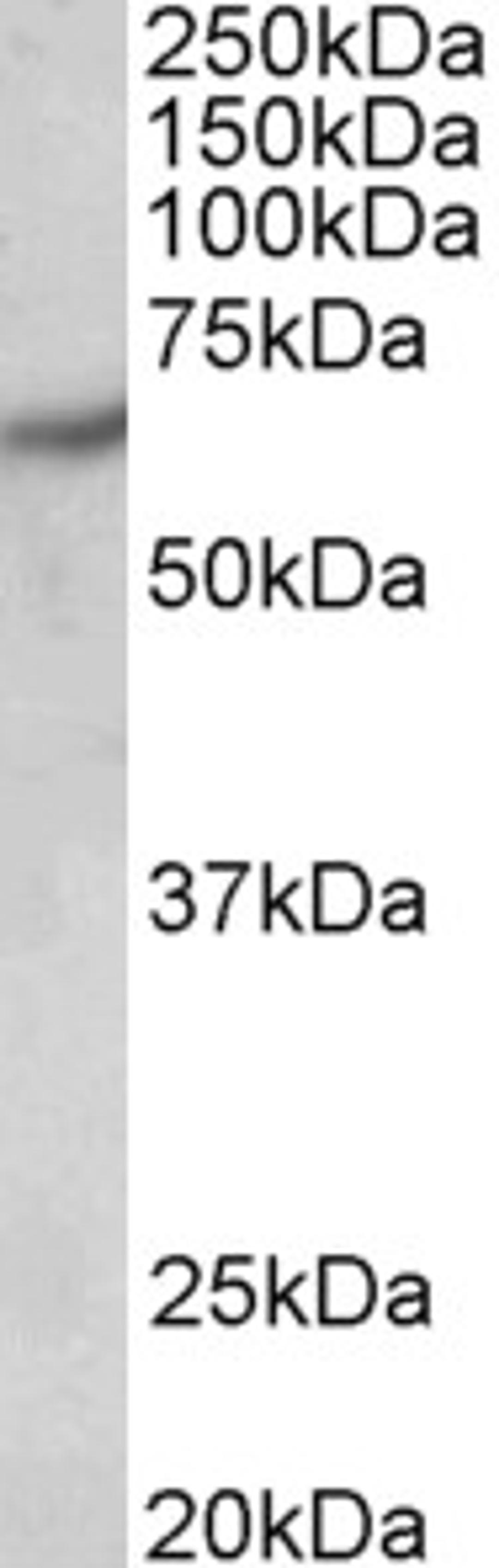 46-127 (0.5ug/ml) staining of Human Brain (Cerebral Cortex) lysate (35ug protein in RIPA buffer). Primary incubation was 1 hour. Detected by chemiluminescence.