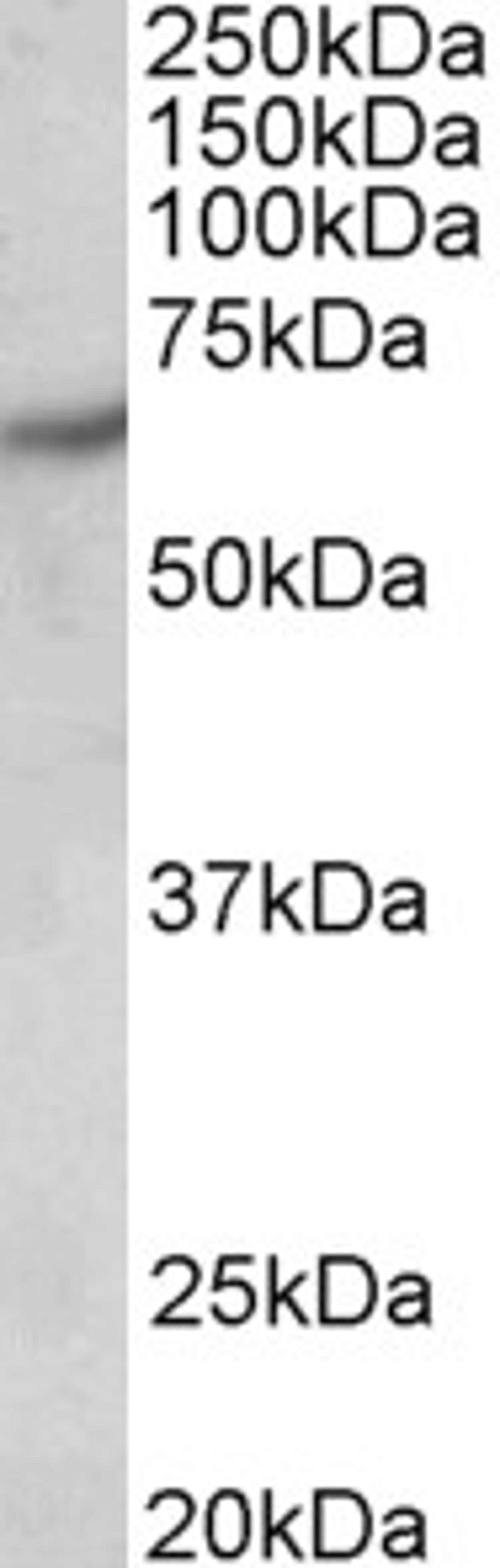 46-127 (0.5ug/ml) staining of Human Brain (Cerebral Cortex) lysate (35ug protein in RIPA buffer). Primary incubation was 1 hour. Detected by chemiluminescence.