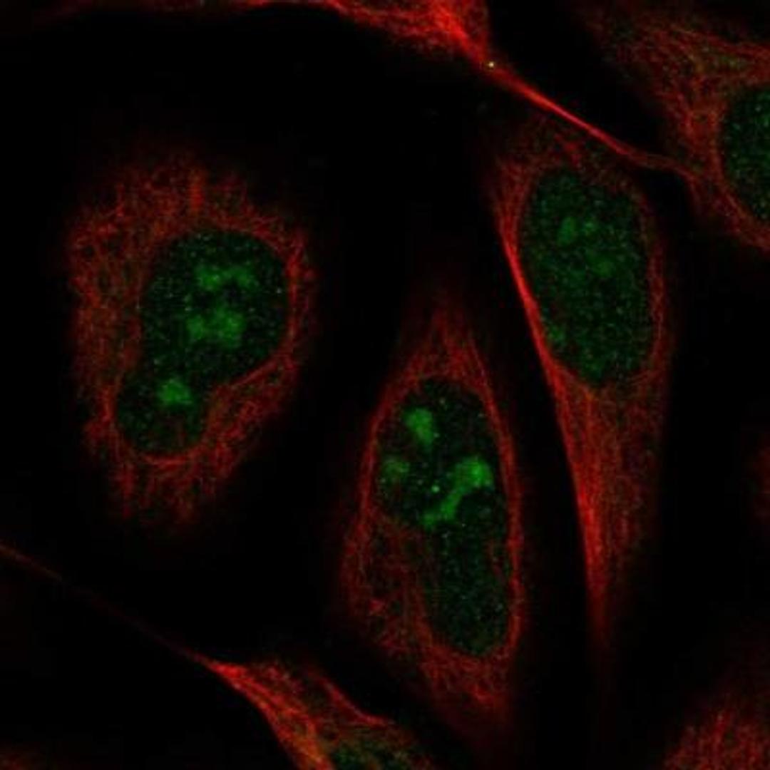 Immunocytochemistry/Immunofluorescence: Carbonic Anhydrase XIII/CA13 Antibody [NBP1-86606] - Staining of human cell line U-2 OS shows positivity in nucleoli.