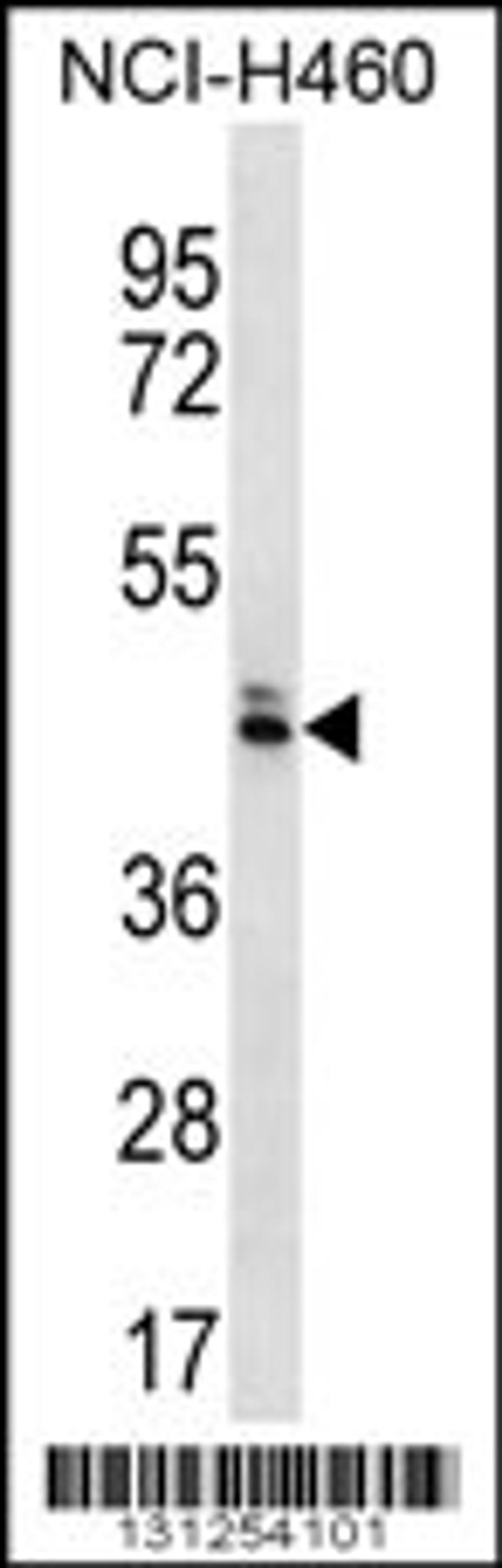 Western blot analysis in NCI-H460 cell line lysates (35ug/lane).