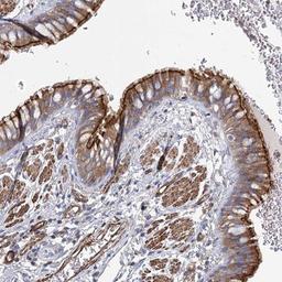 Immunohistochemistry-Paraffin: ITF46 Antibody [NBP1-89910] - Staining of human bronchus shows moderate cytoplasmic and membrane positivity in respiratory epithelial cells.