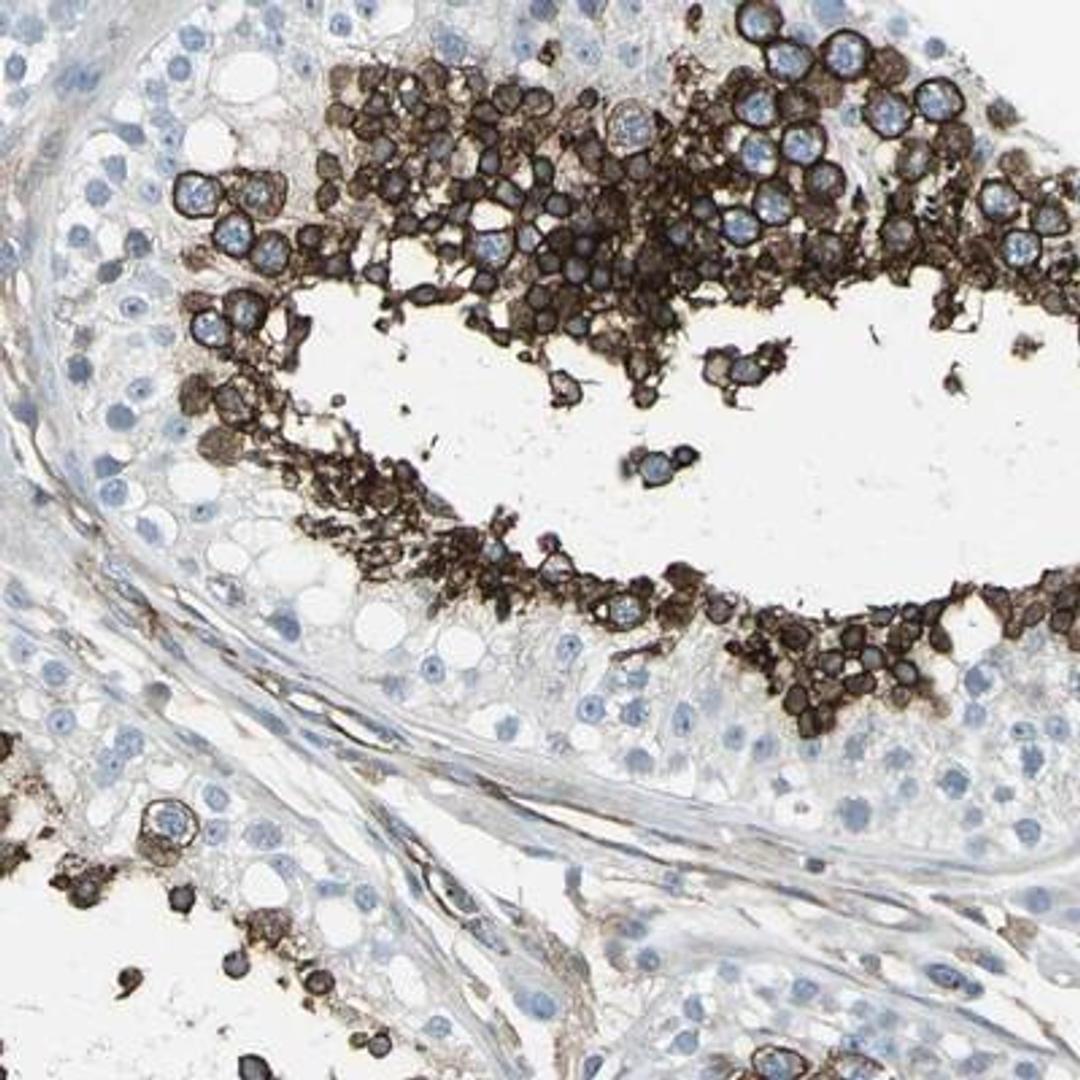 Immunohistochemistry: Glut3 Antibody [NBP1-89762] - Staining of human testis shows strong cytoplasmic positivity in cells in seminiferus ducts.