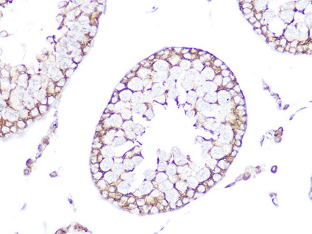 Immunohistochemistry  - Tubulin alpha 1b Rabbit mAb (AC039)