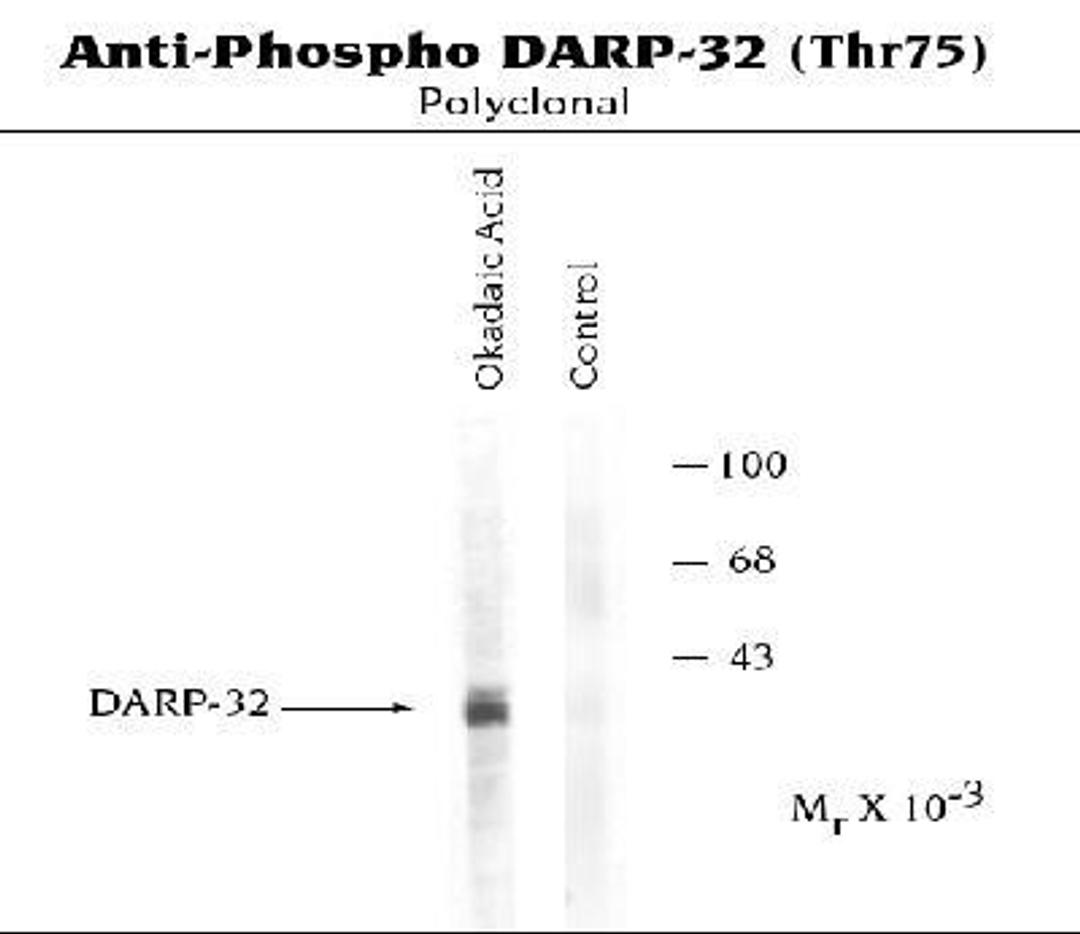 Western Blot: DARPP32 [p Thr75] Antibody [NB300-234] - Analysis of Rat caudate lysates prepared from caudate slices that had been incubated in the absence and presence of okadaic acid. The labeling by the antibody to DARPP-32 Thr75 is markedly increased by the okadaic acid treatment.