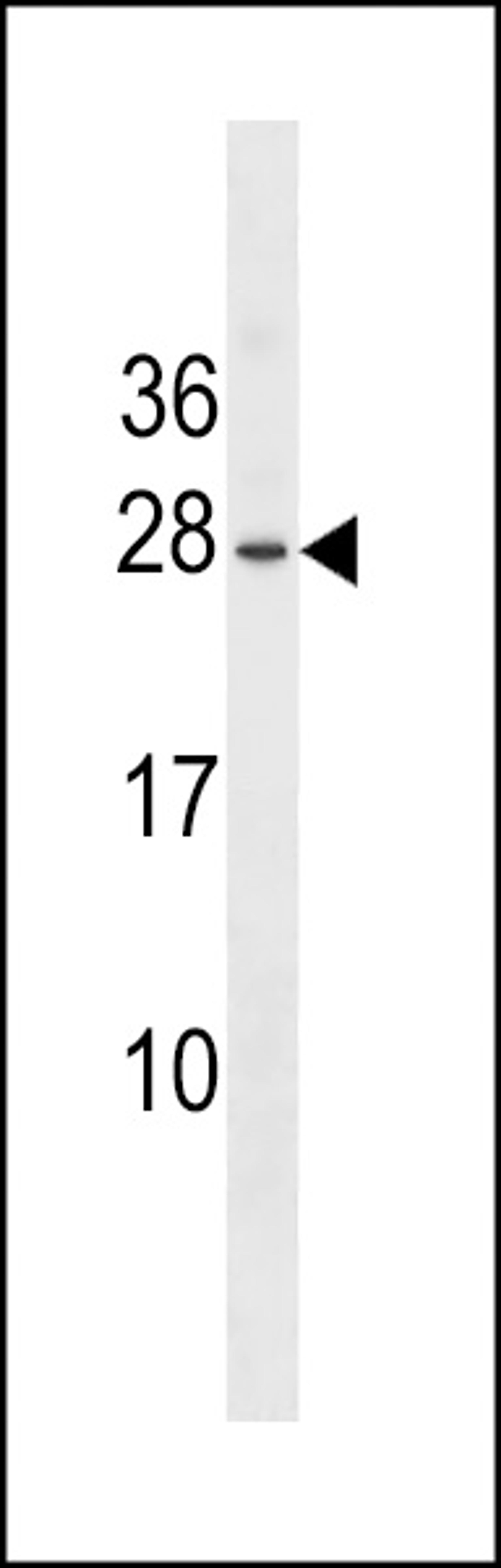 Western blot analysis in WiDr cell line lysates (35ug/lane).This demonstrates the detected the Erythropoietin protein (arrow).