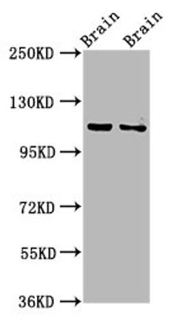 Western Blot. Positive WB detected in: Rat brain tissue, Mouse brain tissue. All lanes: CLIP2 antibody at 3.2ug/ml. Secondary. Goat polyclonal to rabbit IgG at 1/50000 dilution. Predicted band size: 116, 112 kDa. Observed band size: 116 kDa. 