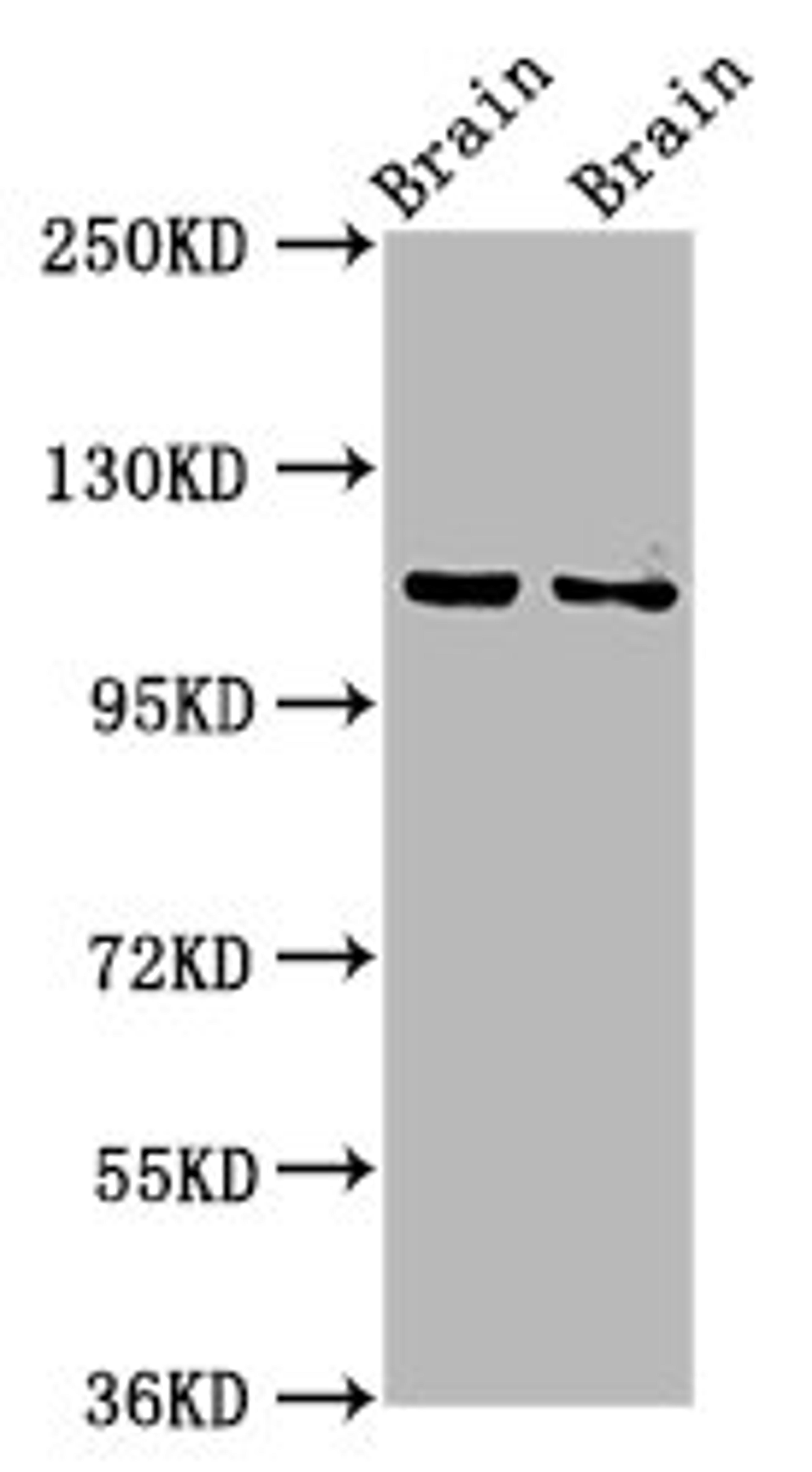 Western Blot. Positive WB detected in: Rat brain tissue, Mouse brain tissue. All lanes: CLIP2 antibody at 3.2ug/ml. Secondary. Goat polyclonal to rabbit IgG at 1/50000 dilution. Predicted band size: 116, 112 kDa. Observed band size: 116 kDa. 