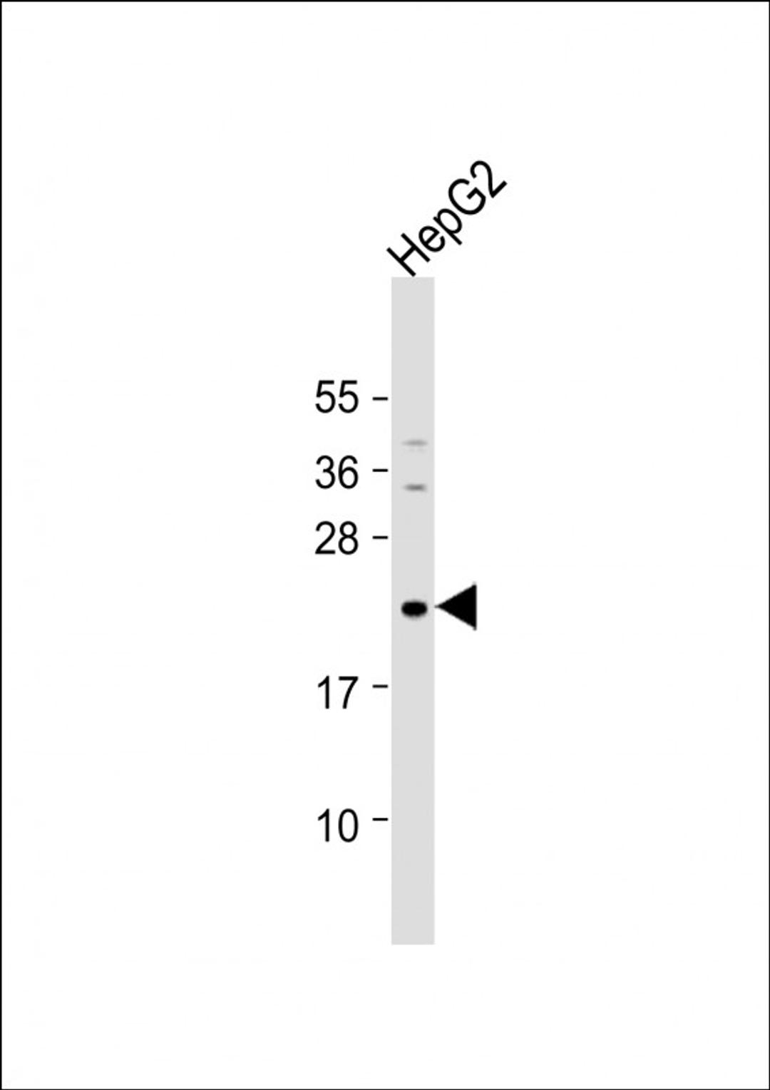 Western Blot at 1:1000 dilution + HepG2 whole cell lysate Lysates/proteins at 20 ug per lane.