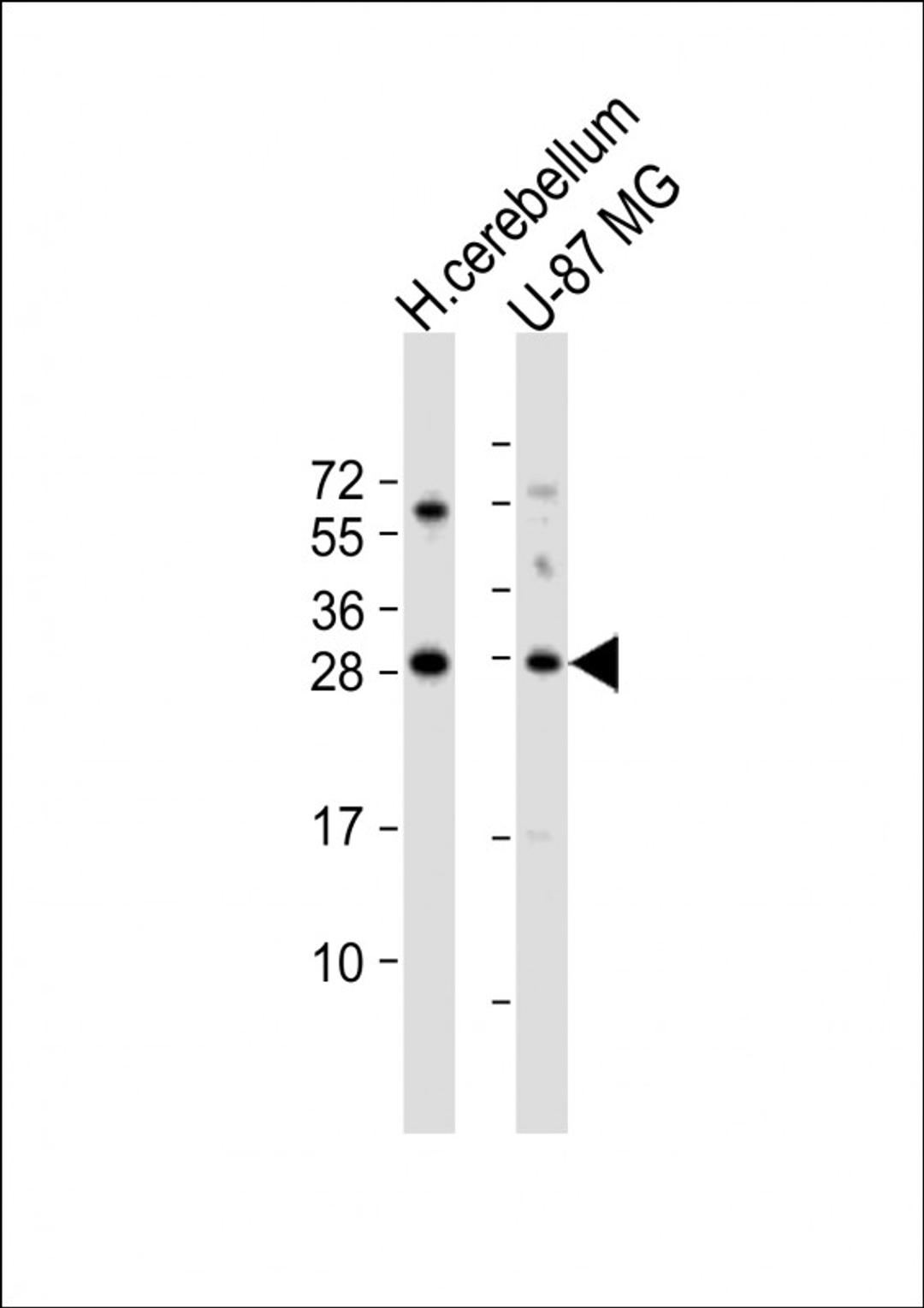 Western Blot at 1:1000 dilution Lane 1: human cerebellum lysate Lane 2: U-87 MG whole cell lysate Lysates/proteins at 20 ug per lane.