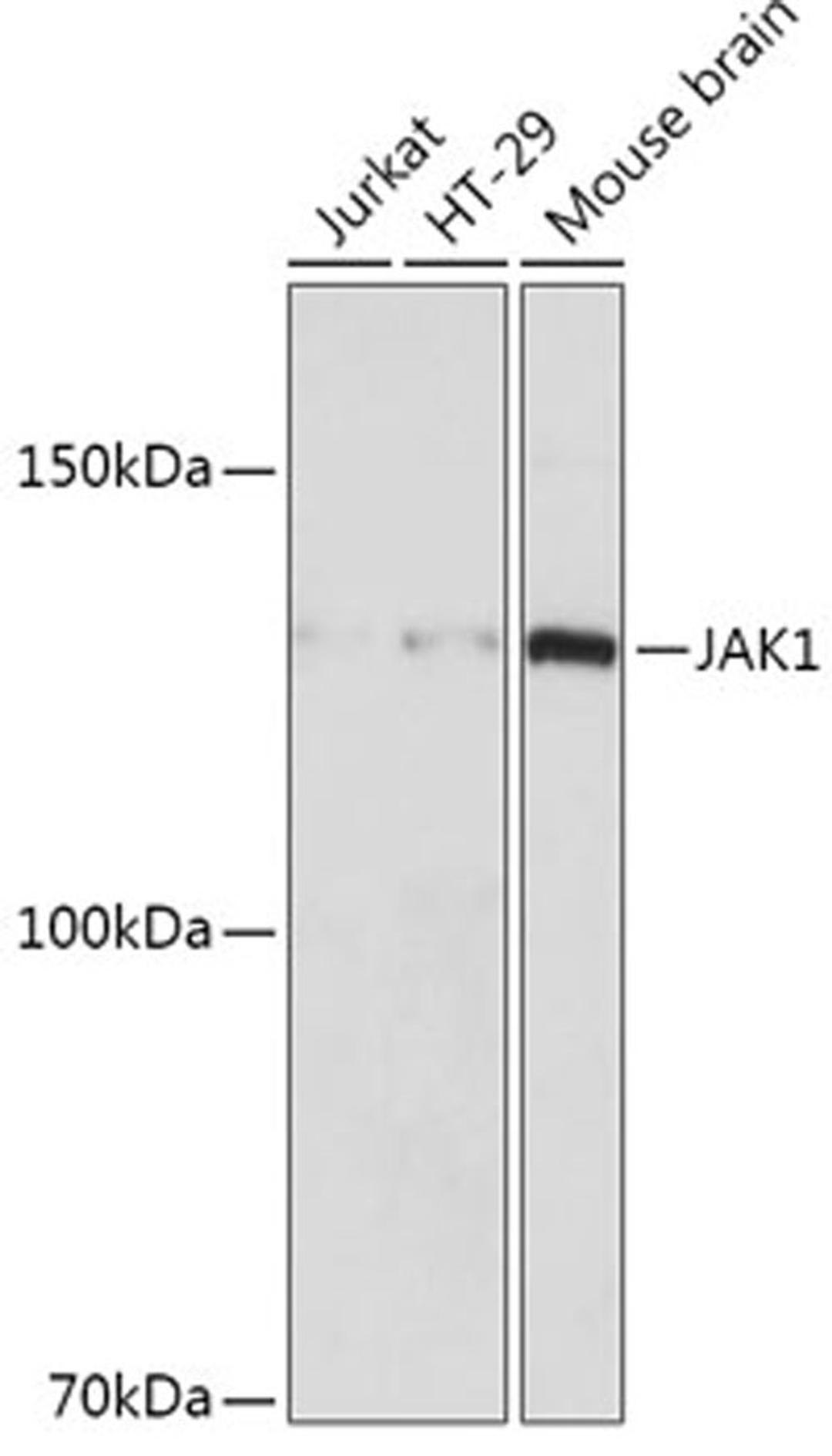 Western blot - JAK1 antibody (A18323)