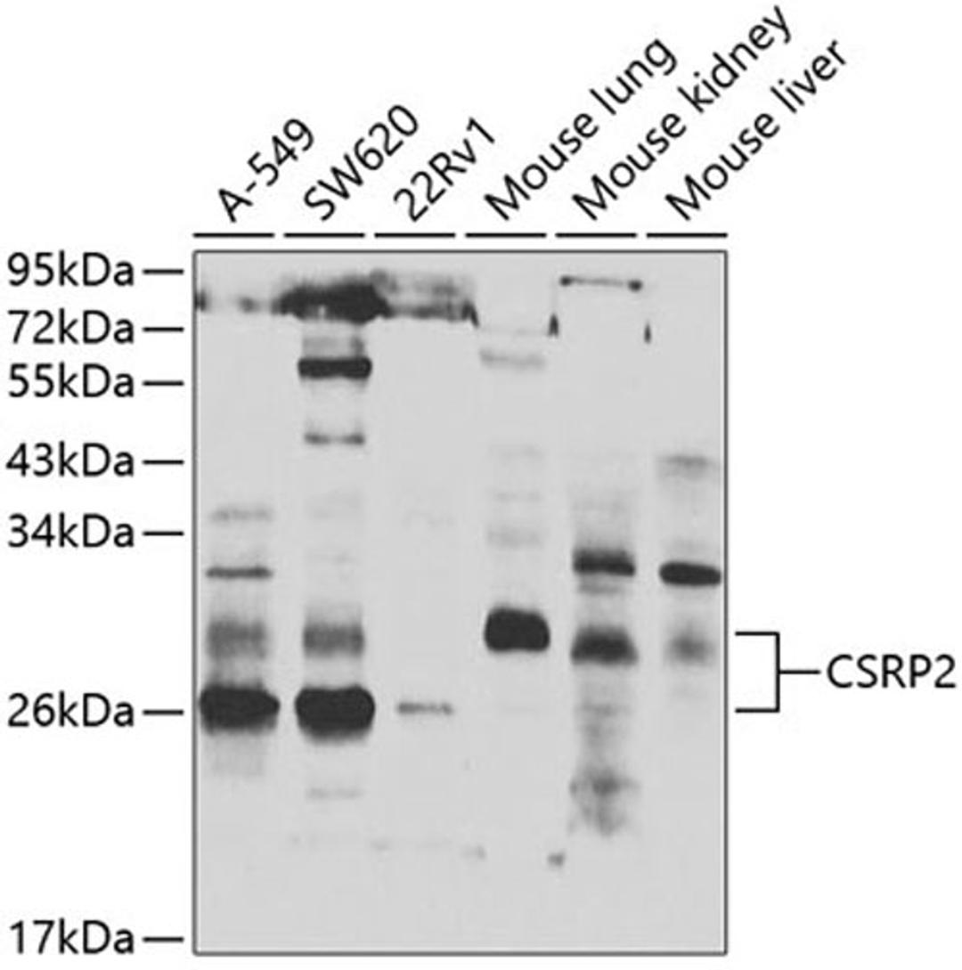 Western blot - CSRP2 antibody (A7549)