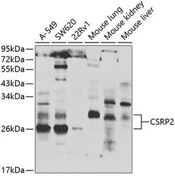 Western blot - CSRP2 antibody (A7549)