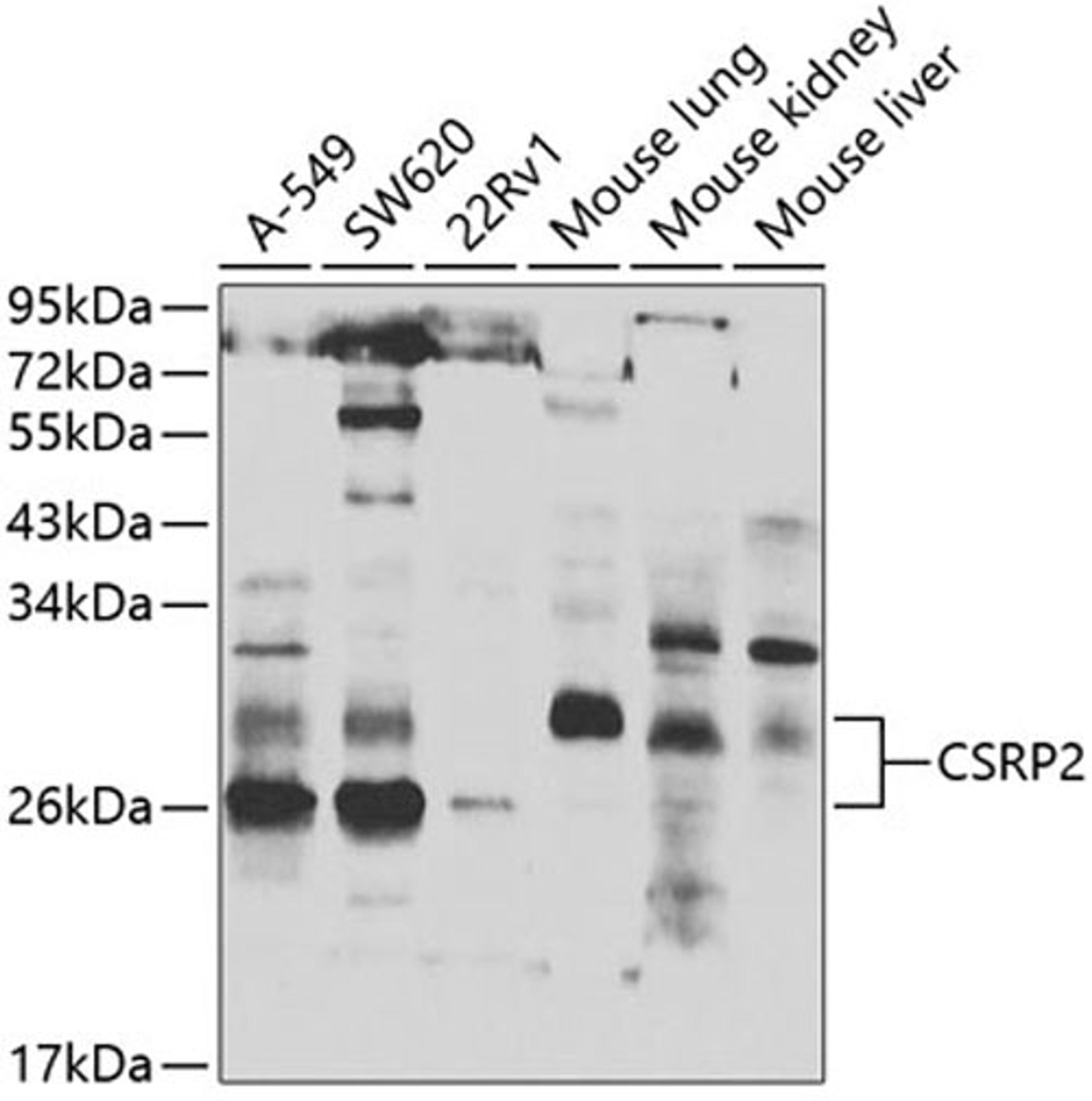 Western blot - CSRP2 antibody (A7549)