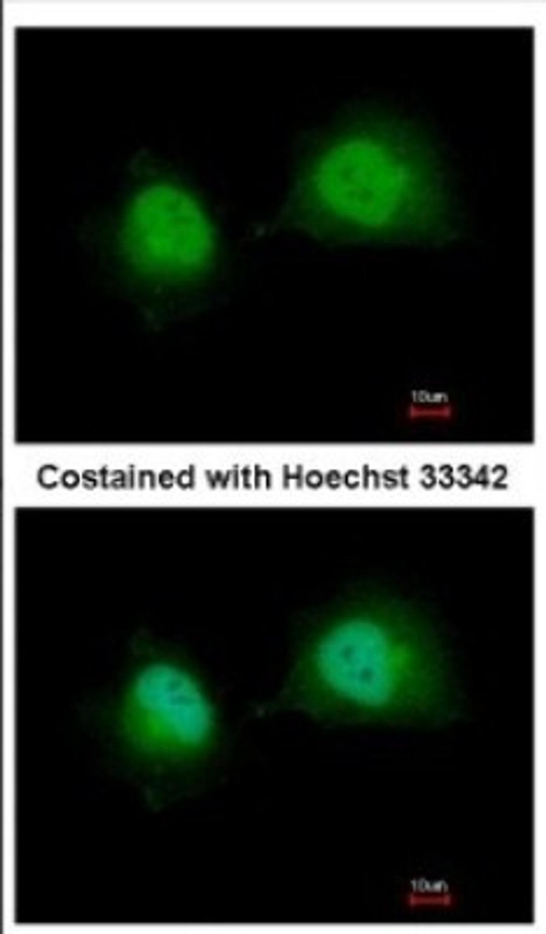 Immunocytochemistry/Immunofluorescence: GTF2A1 Antibody [NBP2-16760] - Immunofluorescence analysis of paraformaldehyde-fixed HeLa, using antibody at 1:500 dilution.