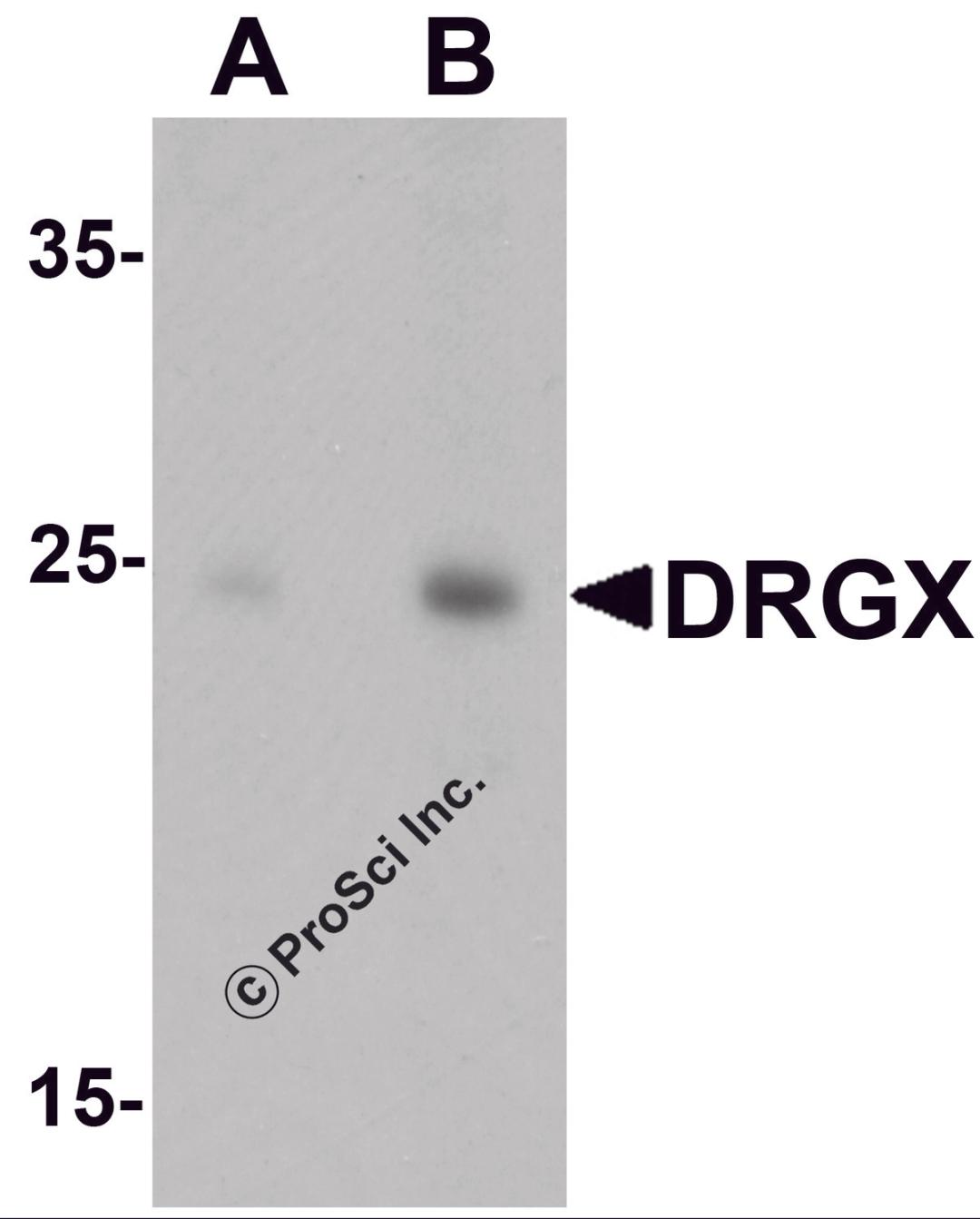 Western blot analysis of DRGX in rat liver tissue lysate with DRGX antibody at (A) 1 and (B) 2 &#956;g/mL.