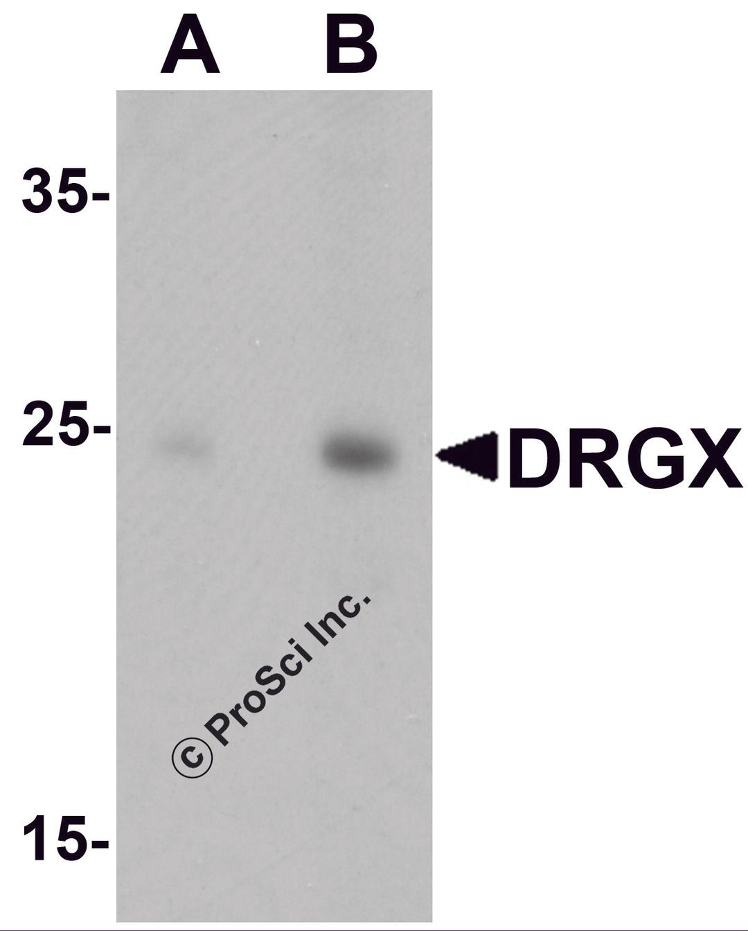 Western blot analysis of DRGX in rat liver tissue lysate with DRGX antibody at (A) 1 and (B) 2 μg/mL.