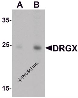 Western blot analysis of DRGX in rat liver tissue lysate with DRGX antibody at (A) 1 and (B) 2 μg/mL.