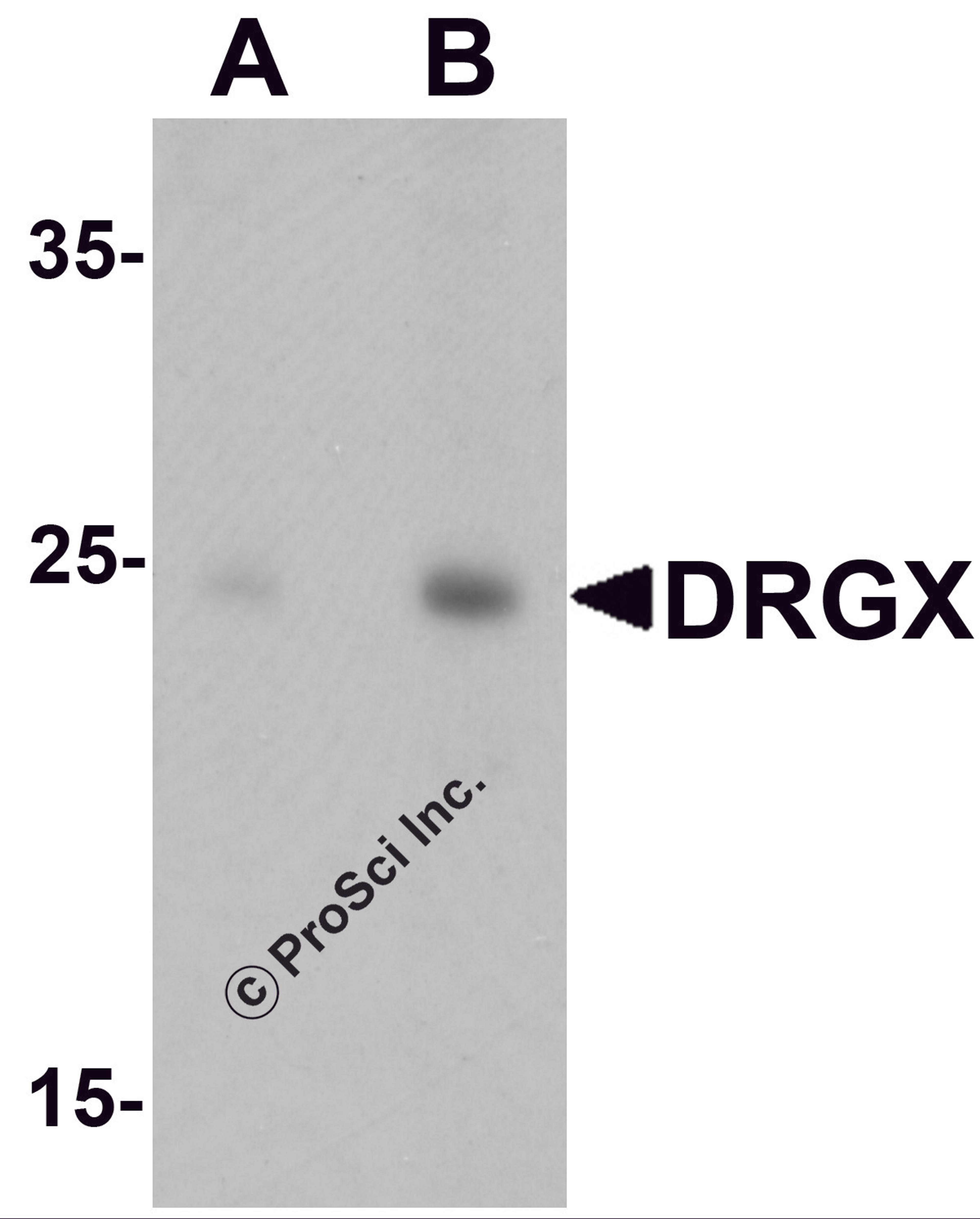 Western blot analysis of DRGX in rat liver tissue lysate with DRGX antibody at (A) 1 and (B) 2 μg/mL.