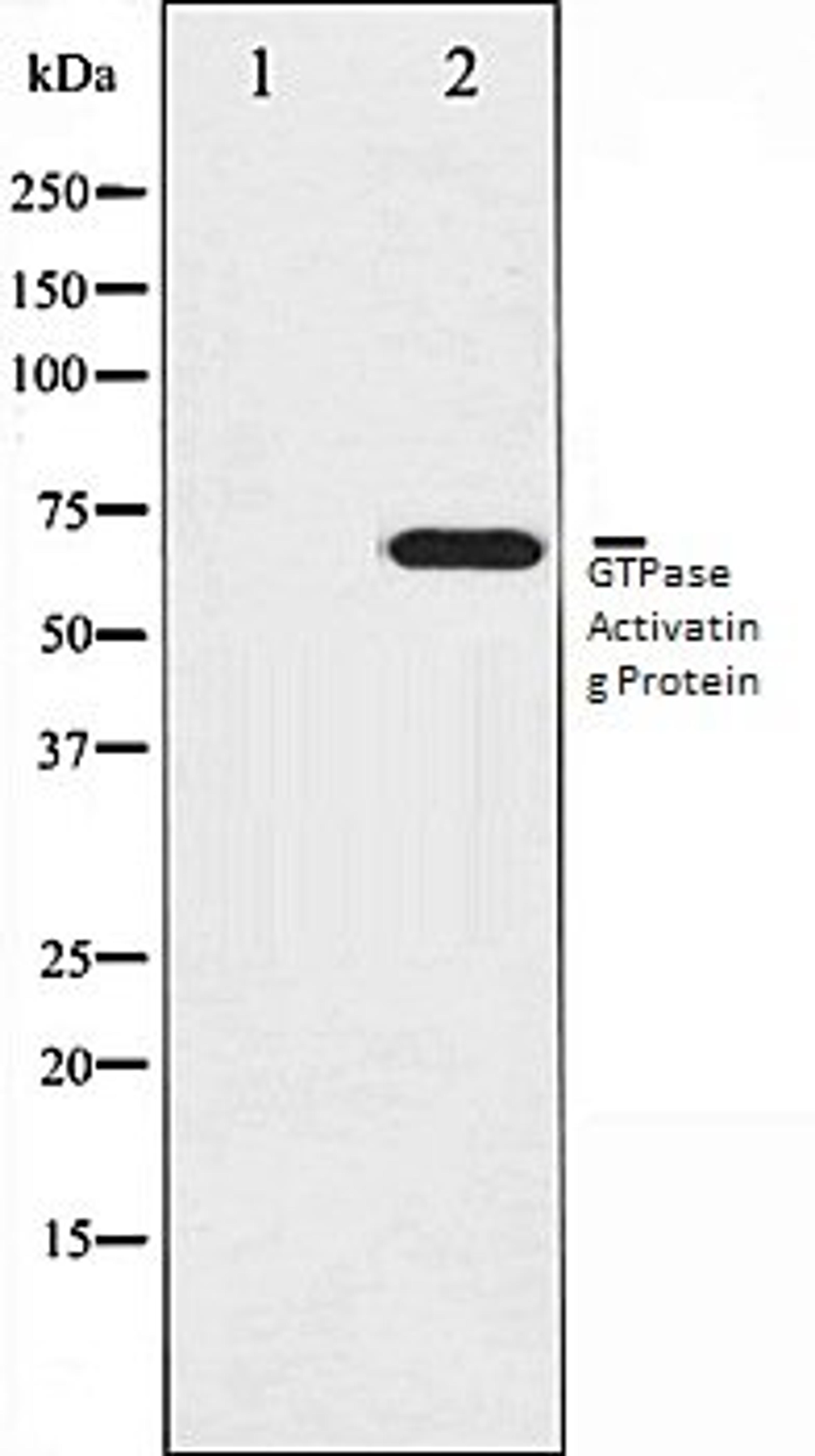 Western blot analysis of COS7 whole cell lysates using GTPase Activating Protein antibody, The lane on the left is treated with the antigen-specific peptide.