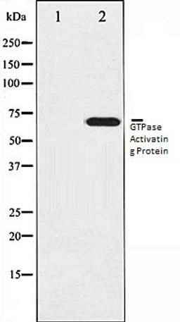 Western blot analysis of COS7 whole cell lysates using GTPase Activating Protein antibody, The lane on the left is treated with the antigen-specific peptide.