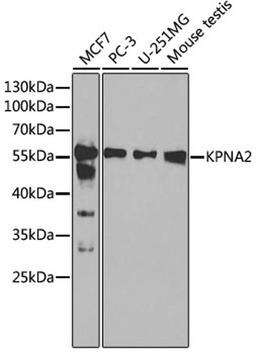 Western blot - KPNA2 antibody (A1623)