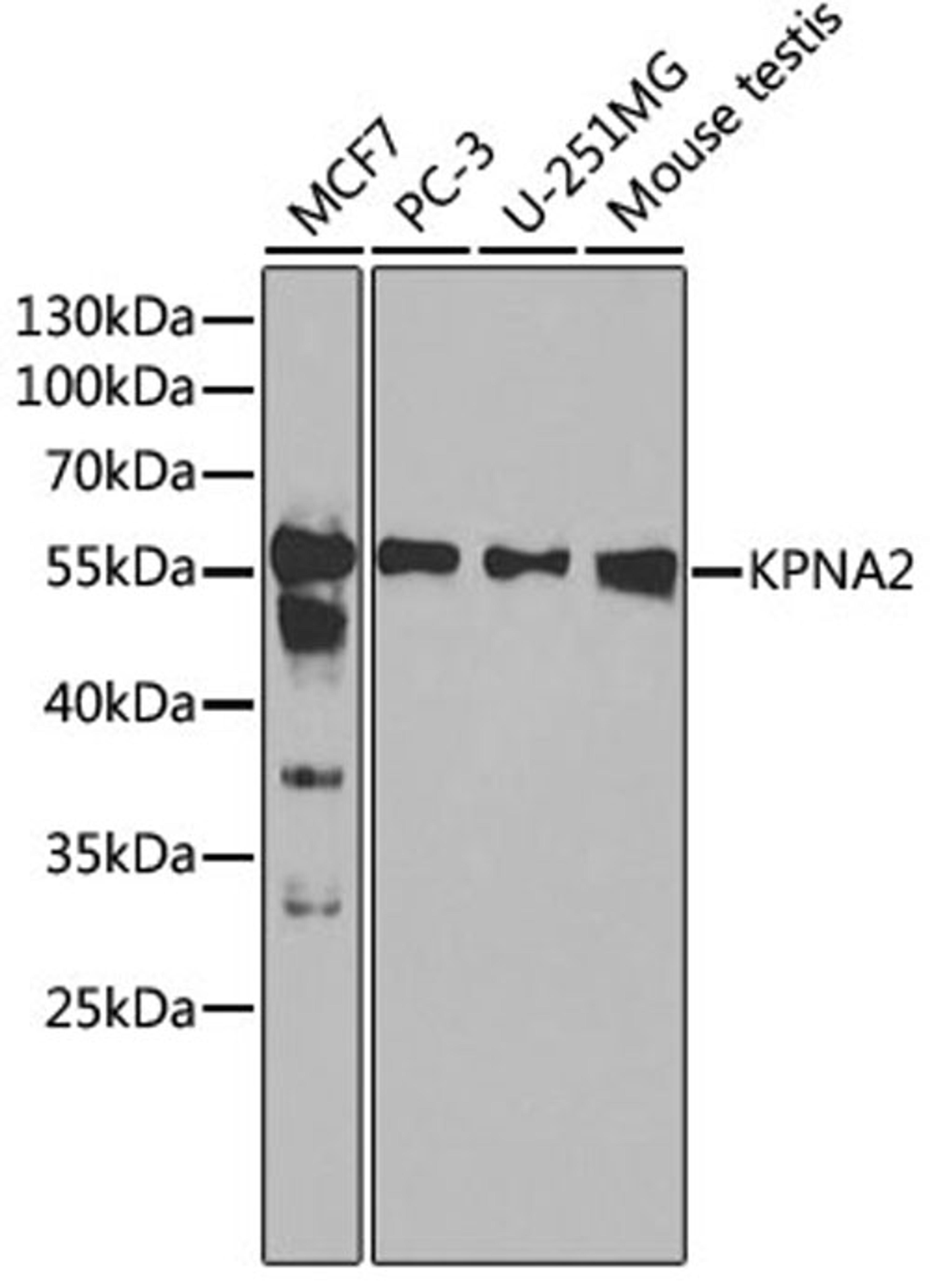 Western blot - KPNA2 antibody (A1623)