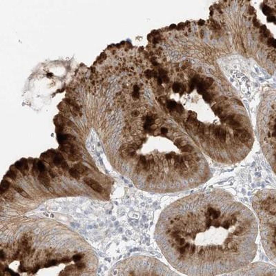 Immunohistochemistry-Paraffin: DGK-theta Antibody [NBP1-85317] - DGKQ Antibody [NBP1-85317] - Staining of human stomach shows strong cytoplasmic positivity in superficial glandular cells.