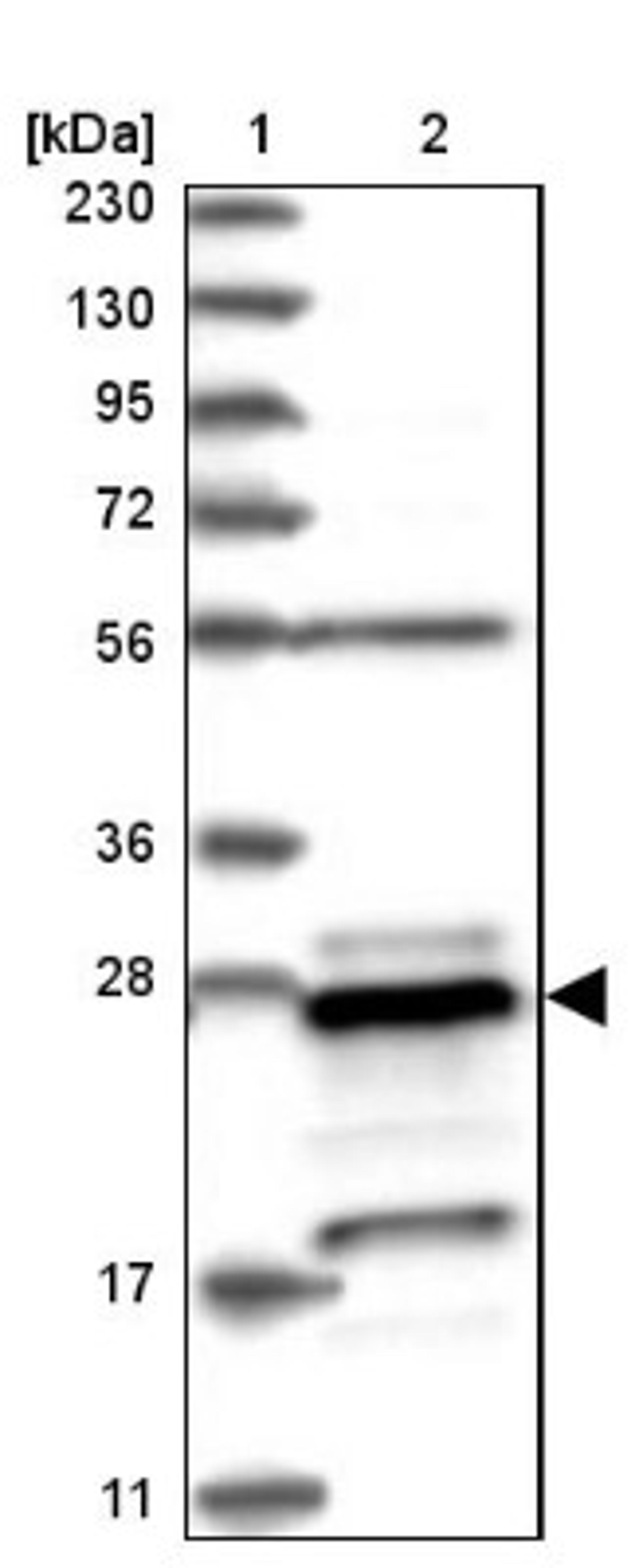 Western Blot: PSMB10 Antibody [NBP1-88660] - Lane 1: Marker [kDa] 230, 130, 95, 72, 56, 36, 28, 17, 11<br/>Lane 2: Human cell line RT-4