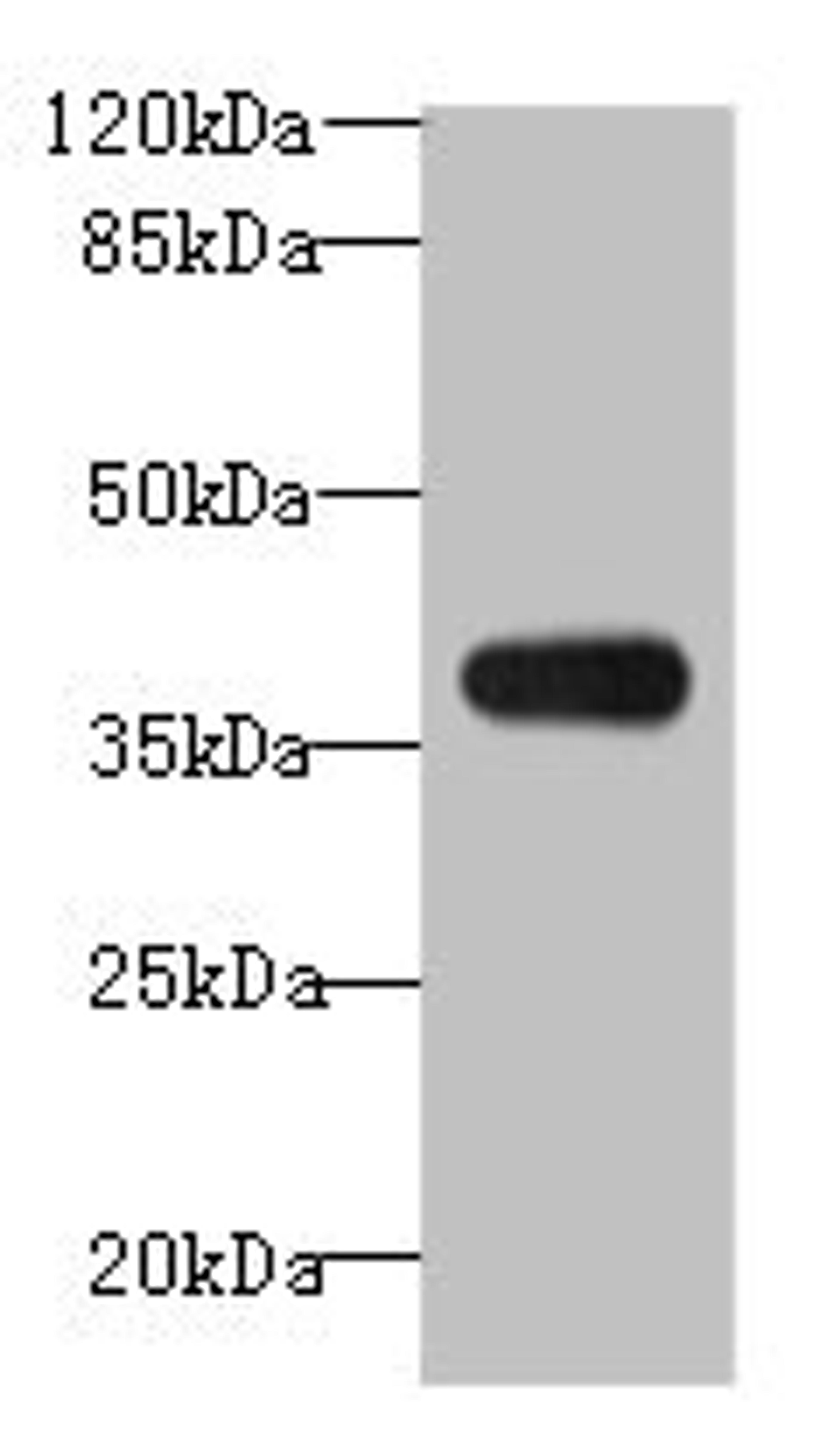 Western blot. All lanes: ASB7 antibody at 8µg/ml + A431 whole cell lysate. Secondary. Goat polyclonal to rabbit IgG at 1/10000 dilution. Predicted band size: 37, 31 kDa. Observed band size: 37 kDa