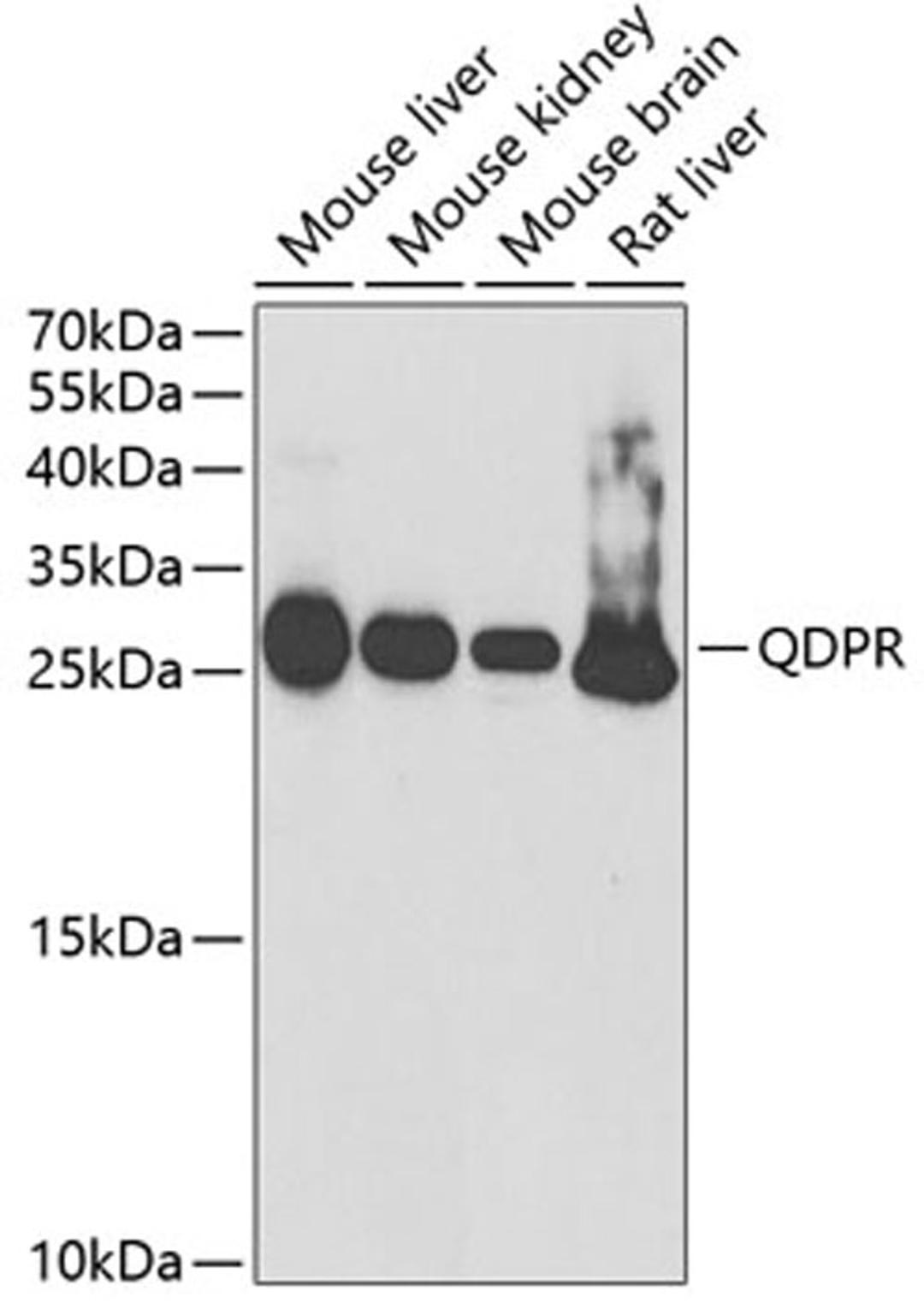 Western blot - QDPR antibody (A5733)