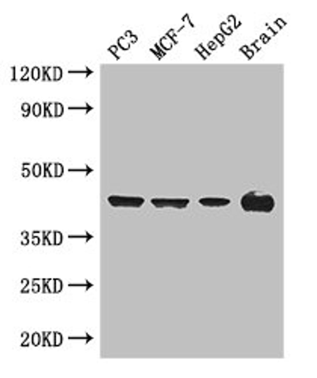 Western Blot. Positive WB detected in: PC-3 whole cell lysate, MCF-7 whole cell lysate, HepG2 whole cell lysate, Mouse brain tissue. All lanes: AMACR antibody at 3ug/ml. Secondary. Goat polyclonal to rabbit IgG at 1/50000 dilution. Predicted band size: 43, 26, 23, 44 kDa. Observed band size: 43 kDa. 