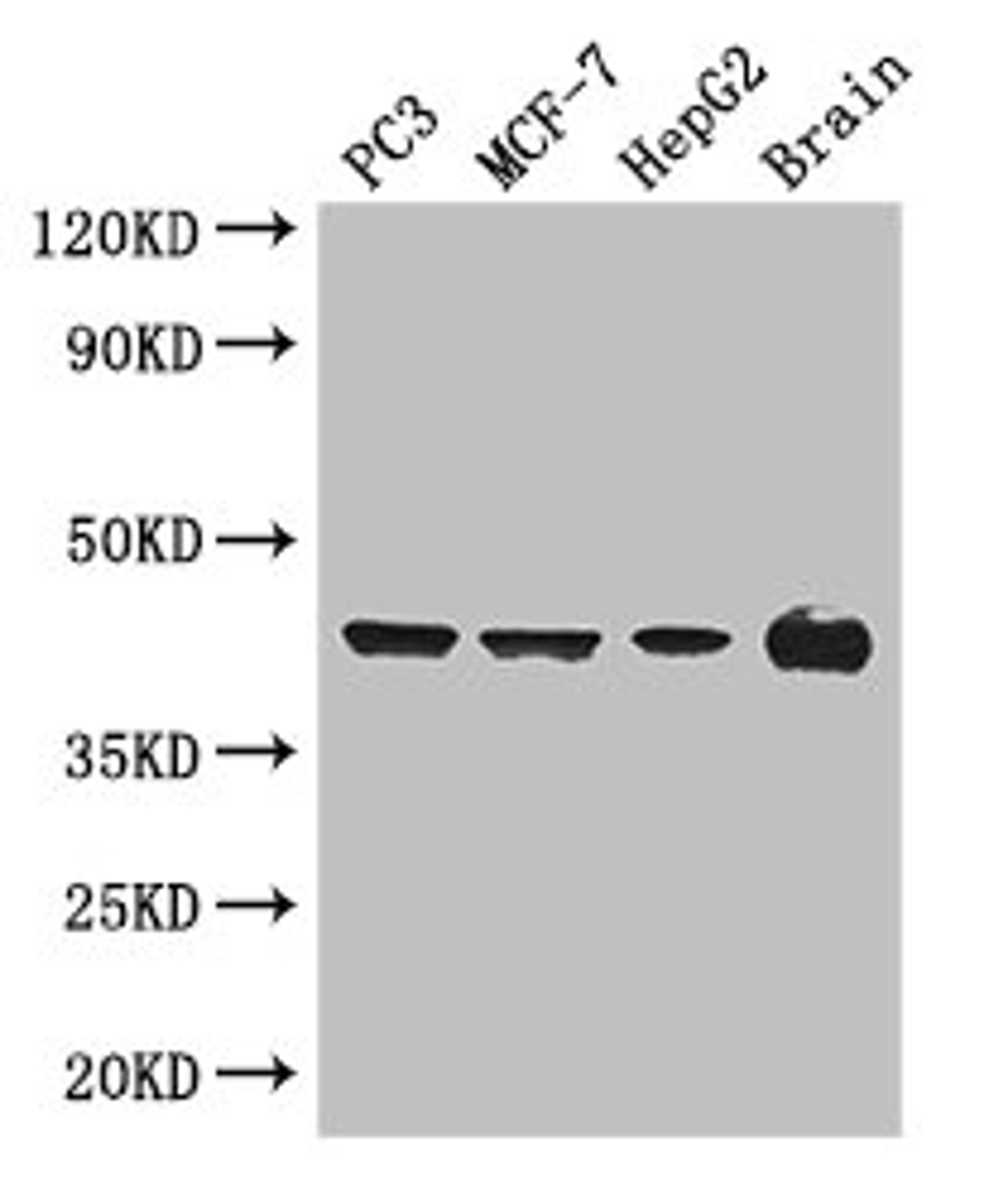 Western Blot. Positive WB detected in: PC-3 whole cell lysate, MCF-7 whole cell lysate, HepG2 whole cell lysate, Mouse brain tissue. All lanes: AMACR antibody at 3ug/ml. Secondary. Goat polyclonal to rabbit IgG at 1/50000 dilution. Predicted band size: 43, 26, 23, 44 kDa. Observed band size: 43 kDa. 