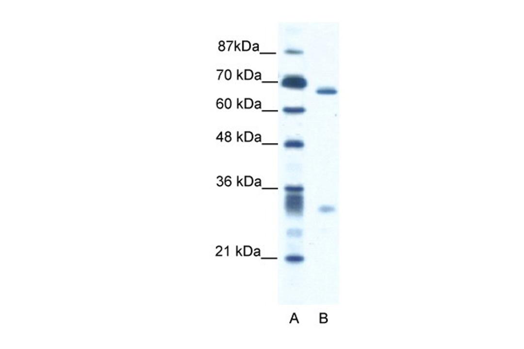 Antibody used in WB on Human Jurkat 2.5 ug/ml.