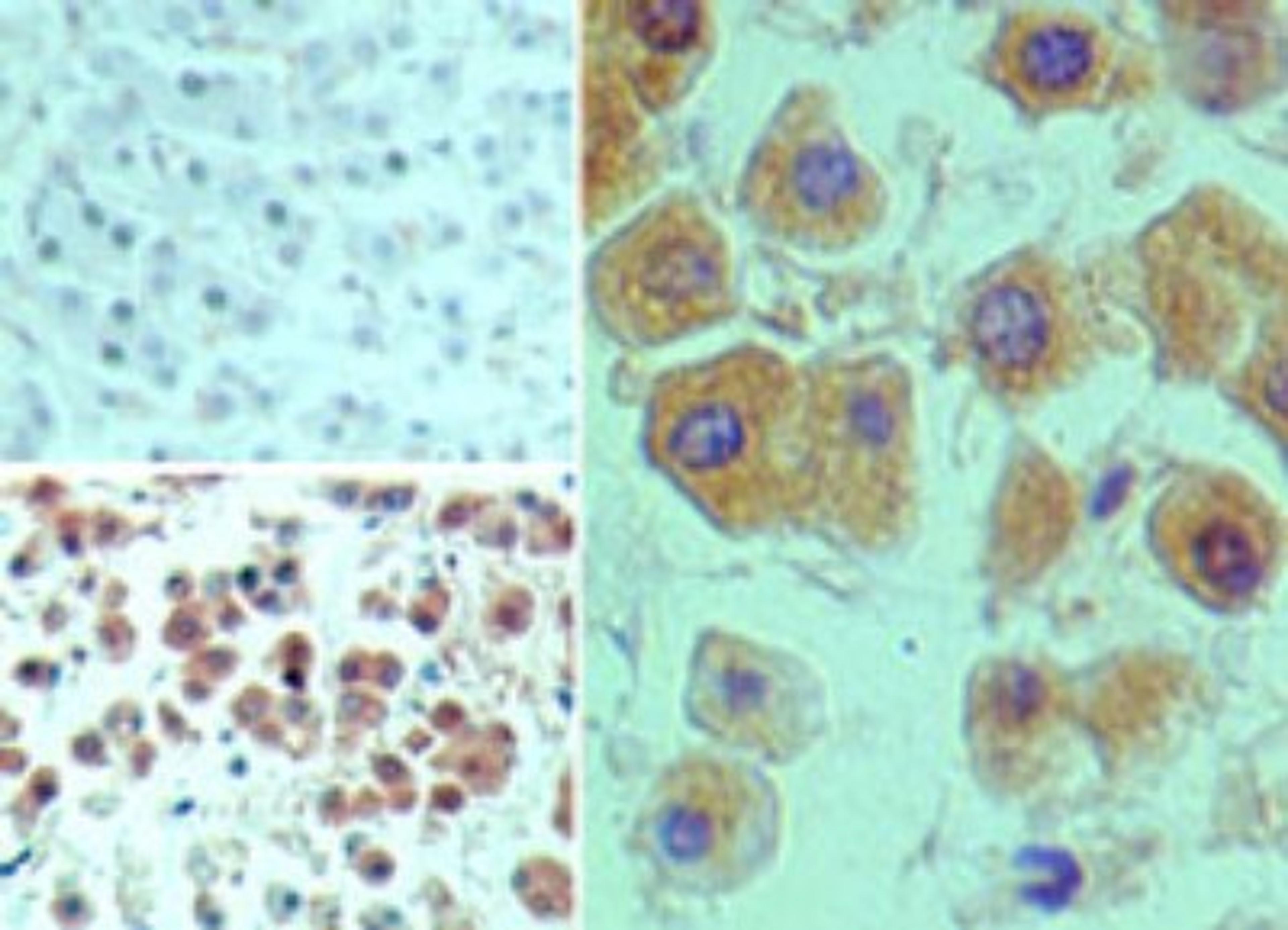 Immunohistochemistry-Paraffin: MEKK2 Antibody [NBP2-24756] - Analysis of MEKK2 in formalin-fixed, paraffin-embedded human liver tissue using an isotype control (top left) and this antibody (bottom left, right) at 5 ug/ml.