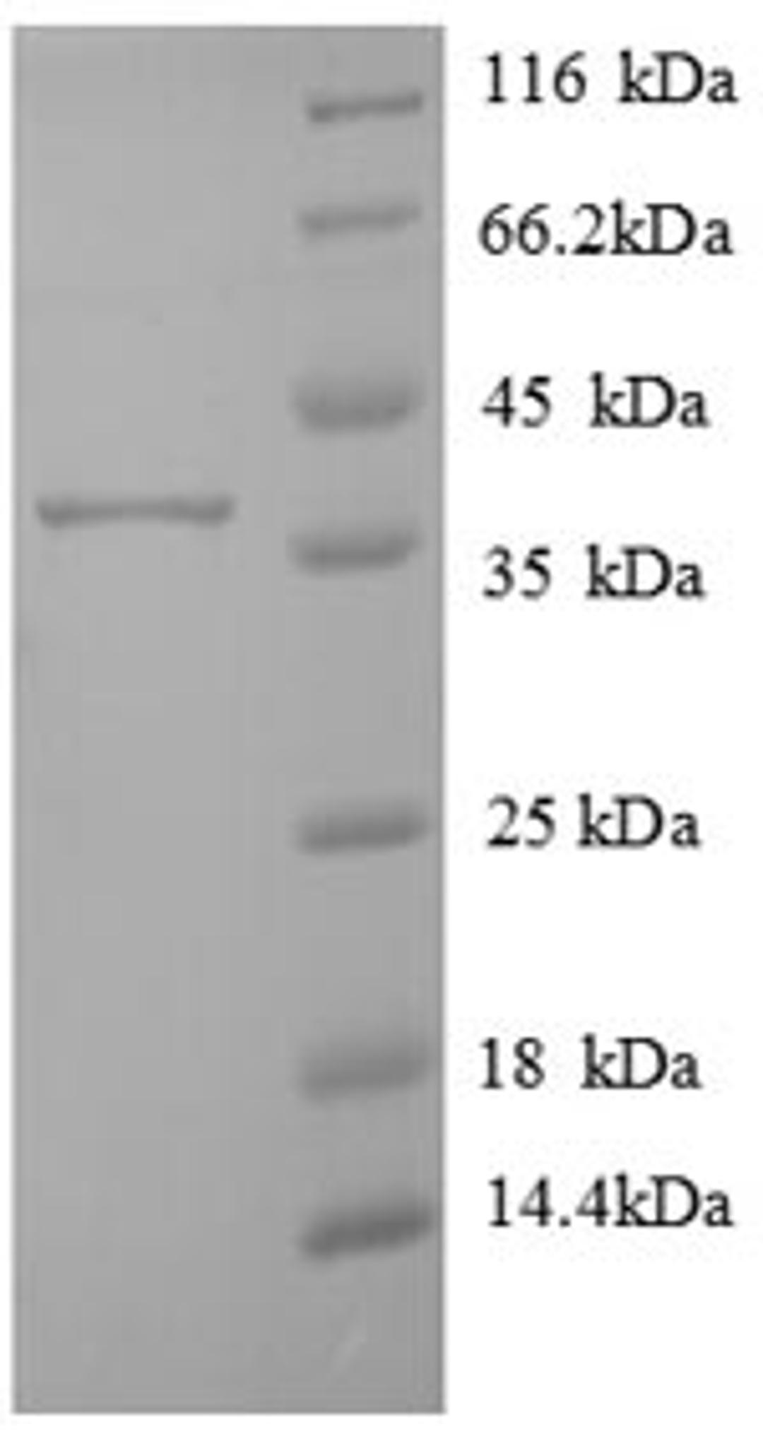 (Tris-Glycine gel) Discontinuous SDS-PAGE (reduced) with 5% enrichment gel and 15% separation gel.