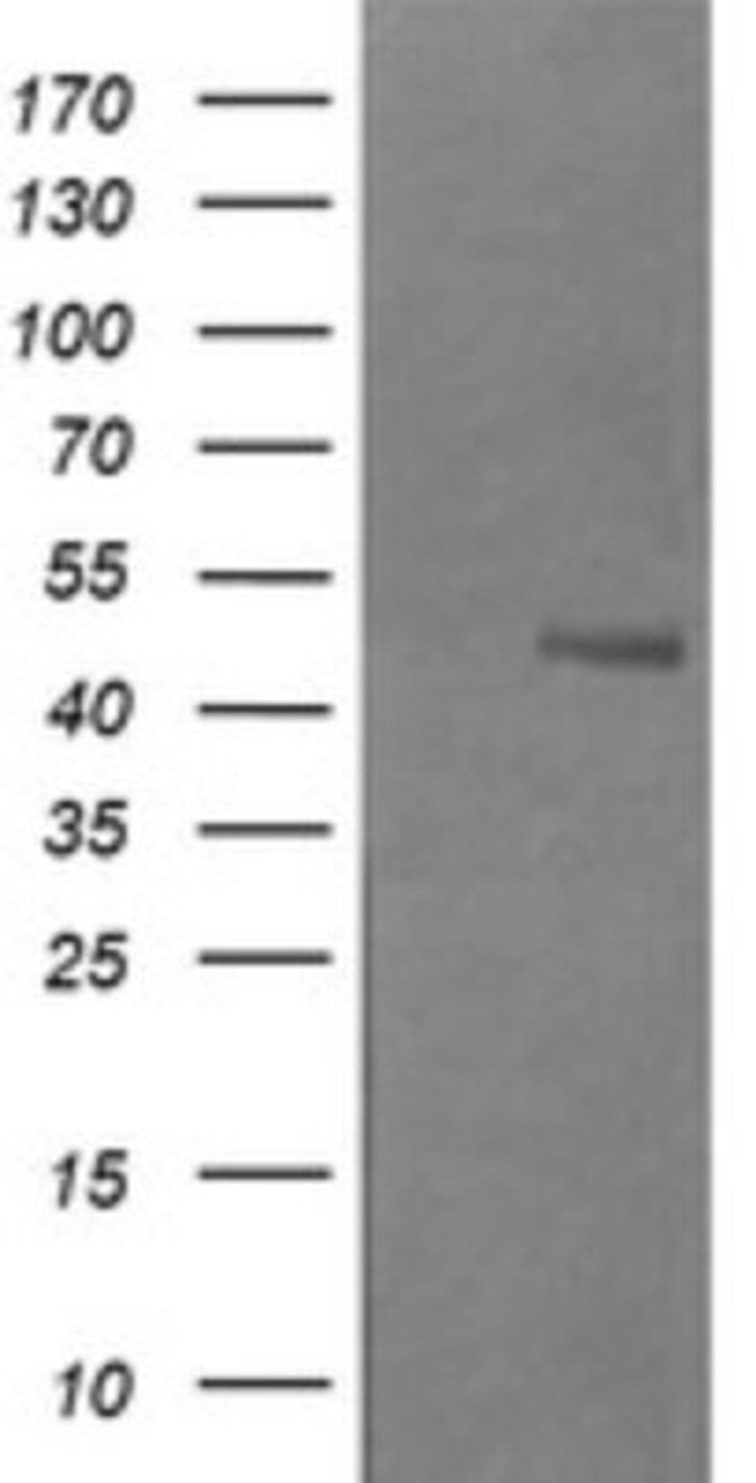 Western Blot: Beta-1,3-N-Acetylglucosaminyltransferase 2/B3GNT2 Antibody (3A9) [NBP2-45527] - Analysis of HEK293T cells were transfected with the pCMV6-ENTRY control (Left lane) or pCMV6-ENTRY B3GNT2.