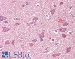 45-706 (3.75ug/ml) staining of paraffin embedded Human Cortex. Steamed antigen retrieval with citrate buffer pH 6, AP-staining.