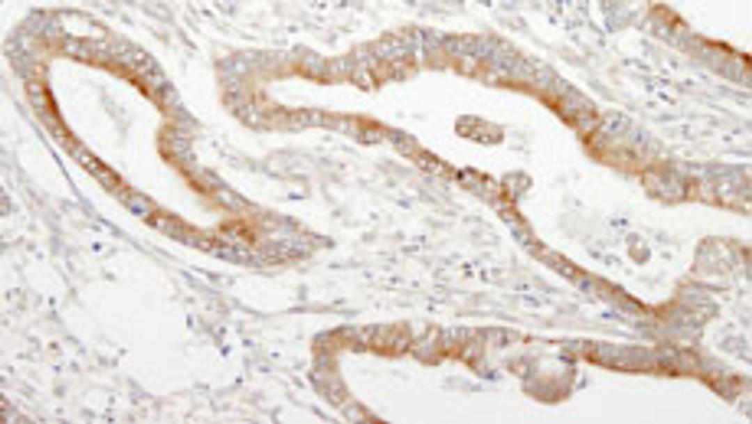 Detection of human MAP7 by immunohistochemistry.