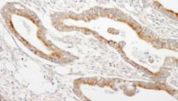 Detection of human MAP7 by immunohistochemistry.