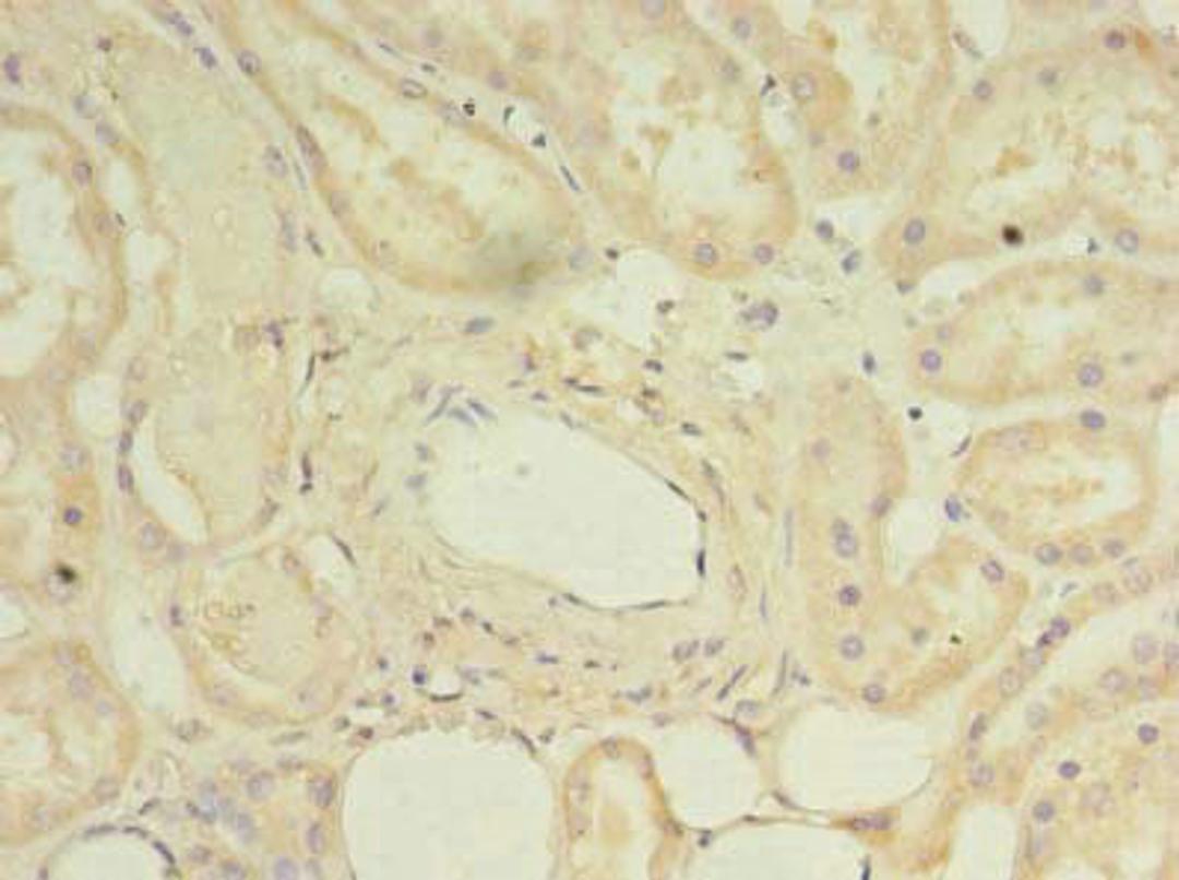 Immunohistochemistry of paraffin-embedded human kidney tissue using CSB-PA882080LA01HU at dilution of 1:100