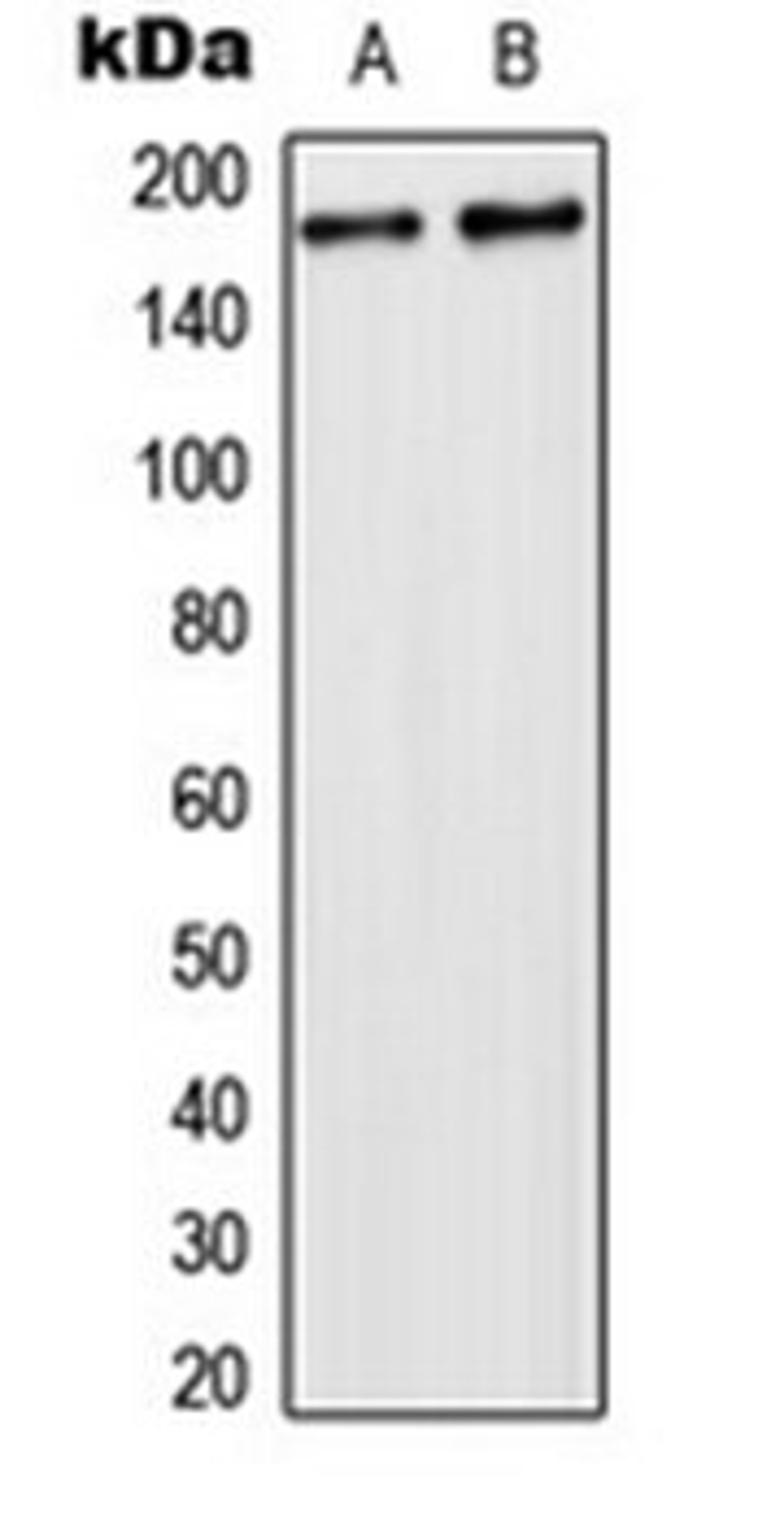 Western blot analysis of HeLa (Lane 1), NIH3T3 (Lane 2) whole cell lysates using USP32 antibody