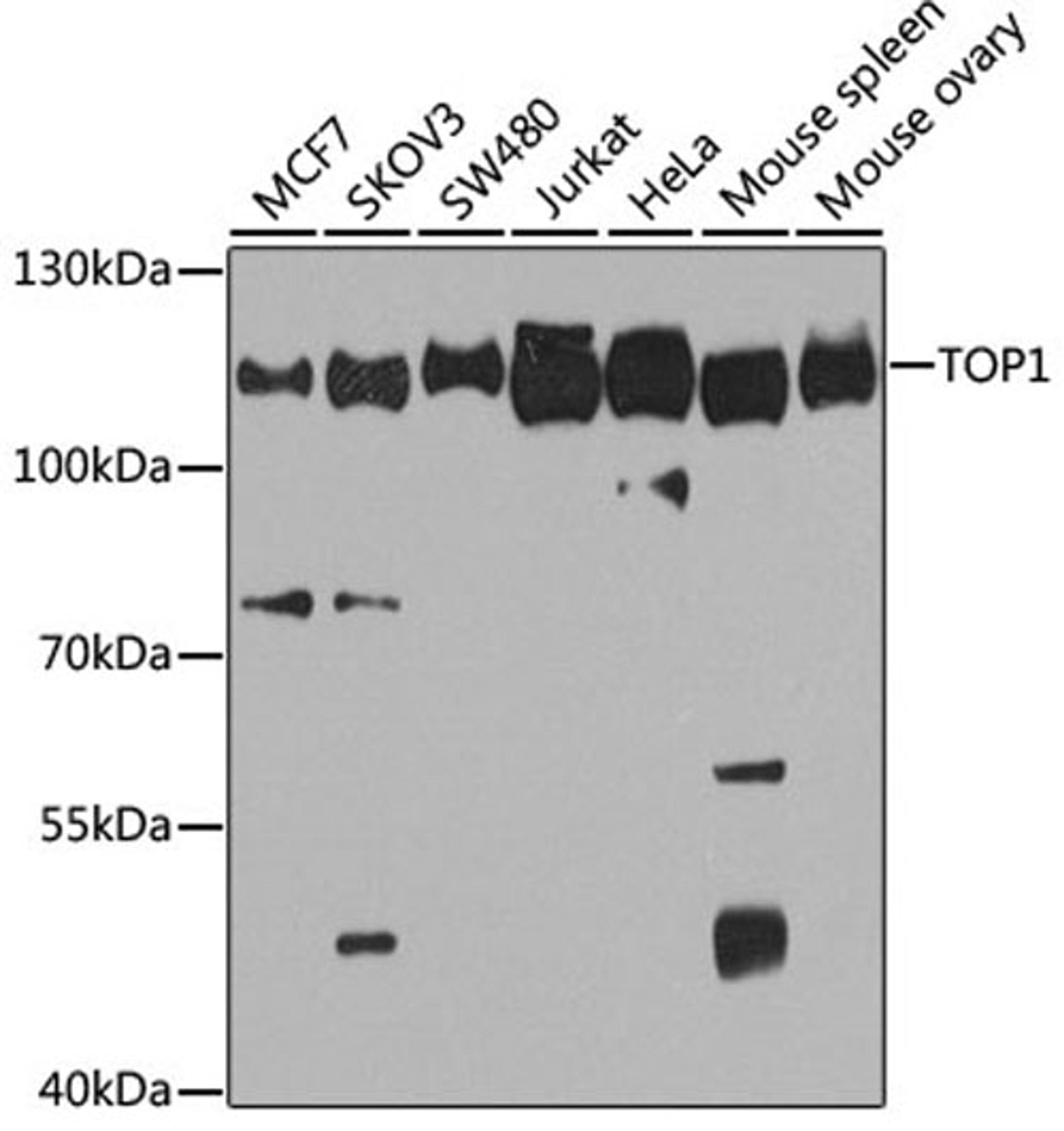 Western blot - TOP1 antibody (A12524)