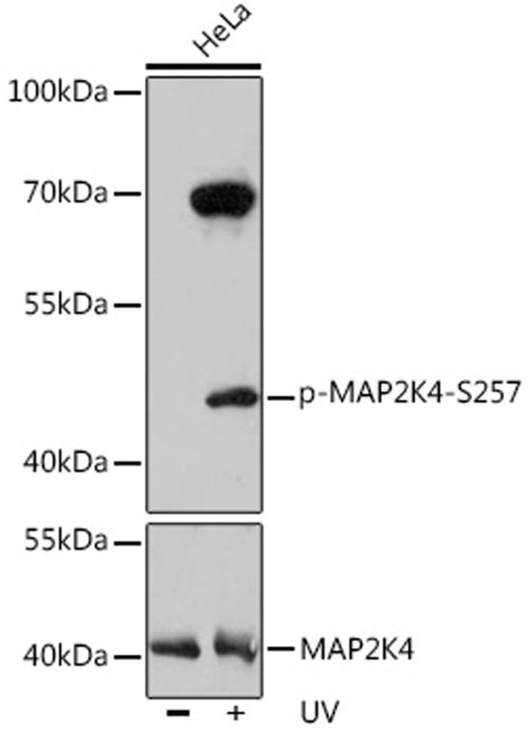 Western blot - Phospho-MAP2K4-S257 pAb (AP0068)