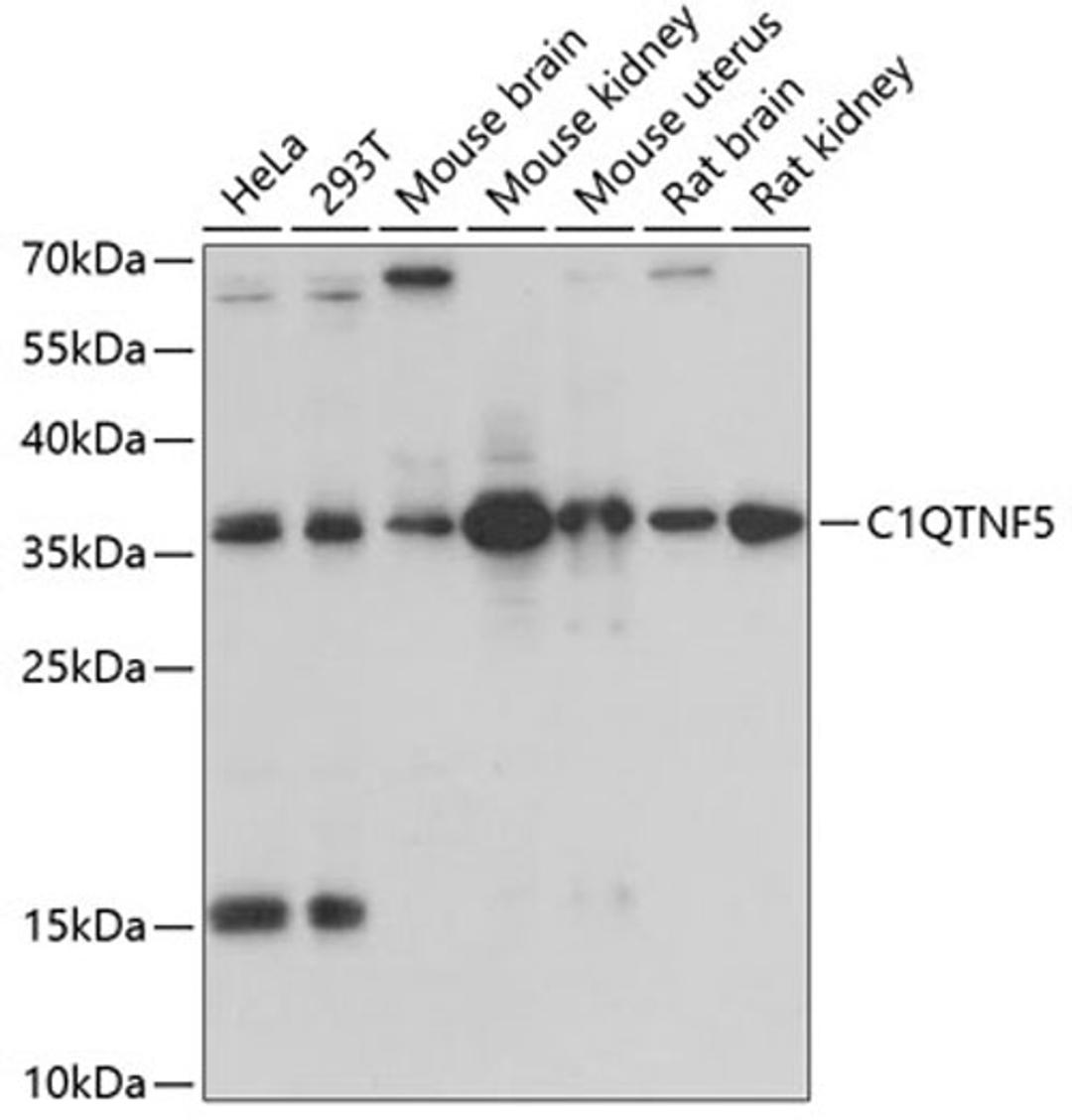 Western blot - C1QTNF5 antibody (A3021)