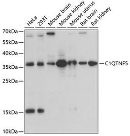 Western blot - C1QTNF5 antibody (A3021)