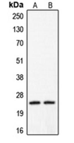 Western blot analysis of HeLa (Lane 1), A431 (Lane 2) whole cell lysates using CLDN2 antibody