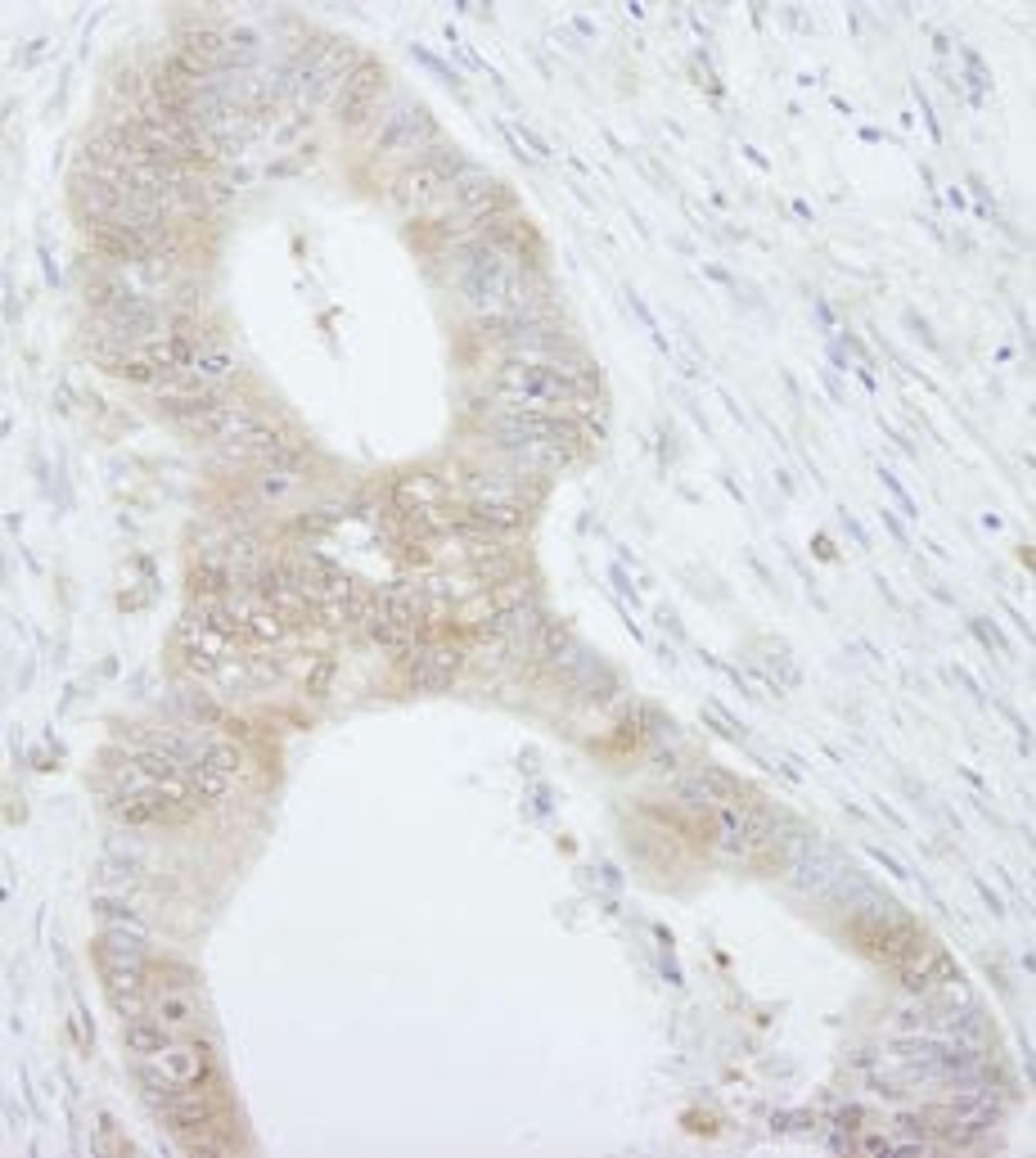 Detection of human 4EBP1 by immunohistochemistry.