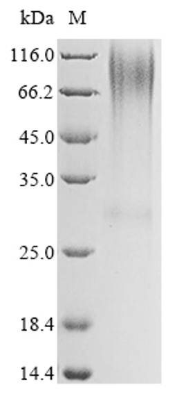 (Tris-Glycine gel) Discontinuous SDS-PAGE (reduced) with 5% enrichment gel and 15% separation gel.