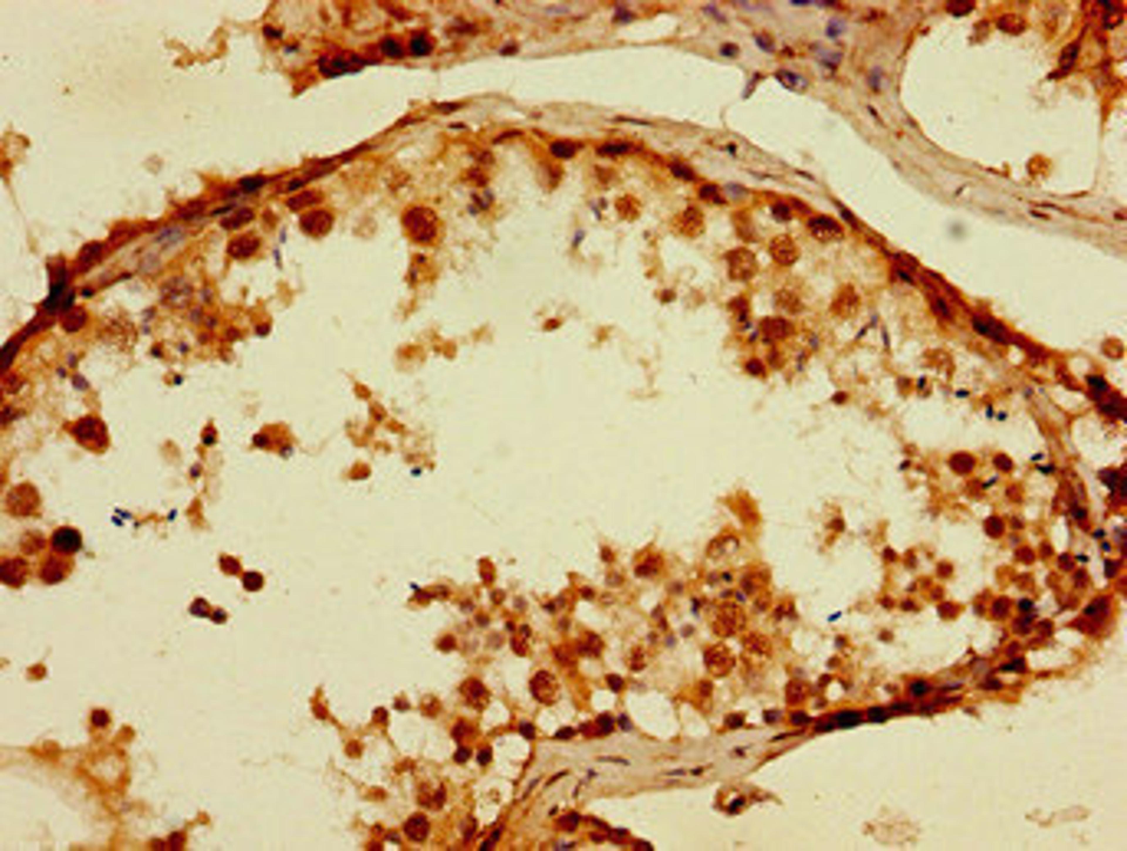 Immunohistochemistry of paraffin-embedded human testis tissue using CSB-PA024128LA01HU at dilution of 1:100
